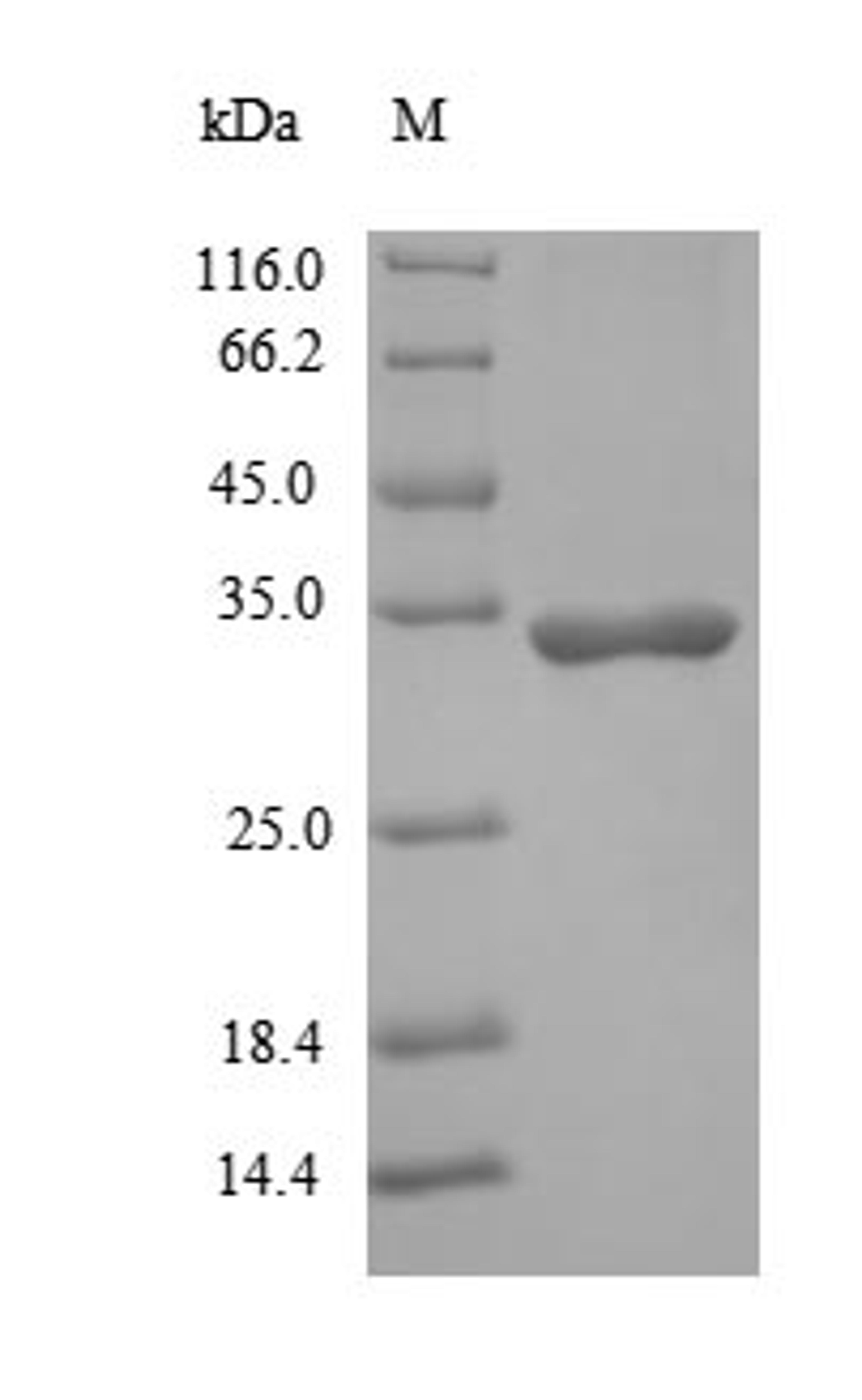 (Tris-Glycine gel) Discontinuous SDS-PAGE (reduced) with 5% enrichment gel and 15% separation gel.