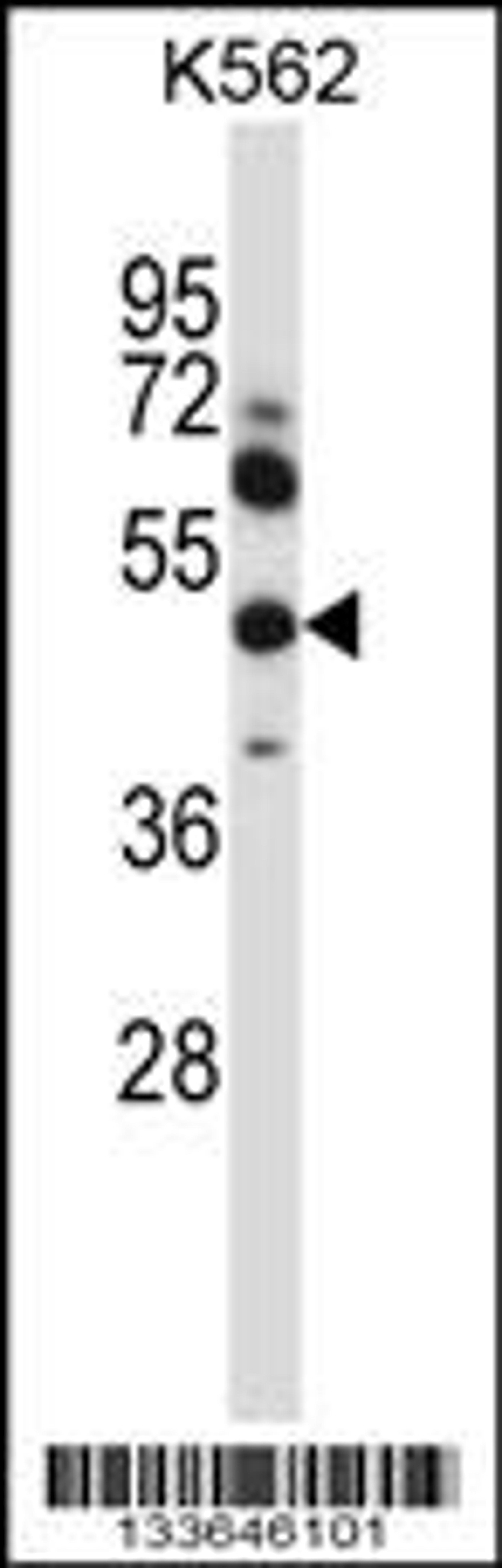 Western blot analysis in K562 cell line lysates (35ug/lane).