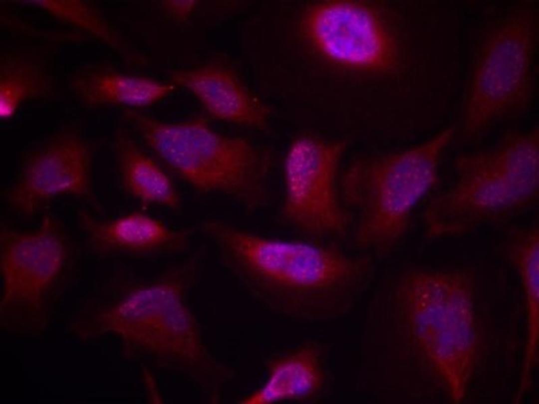 Immunocytochemistry/Immunofluorescence: ATF2 [p Thr73] Antibody [NB100-81800] - Staining of methanol-fixed Hela cells using ATF2 (Phospho-Thr73 or 55) antibody