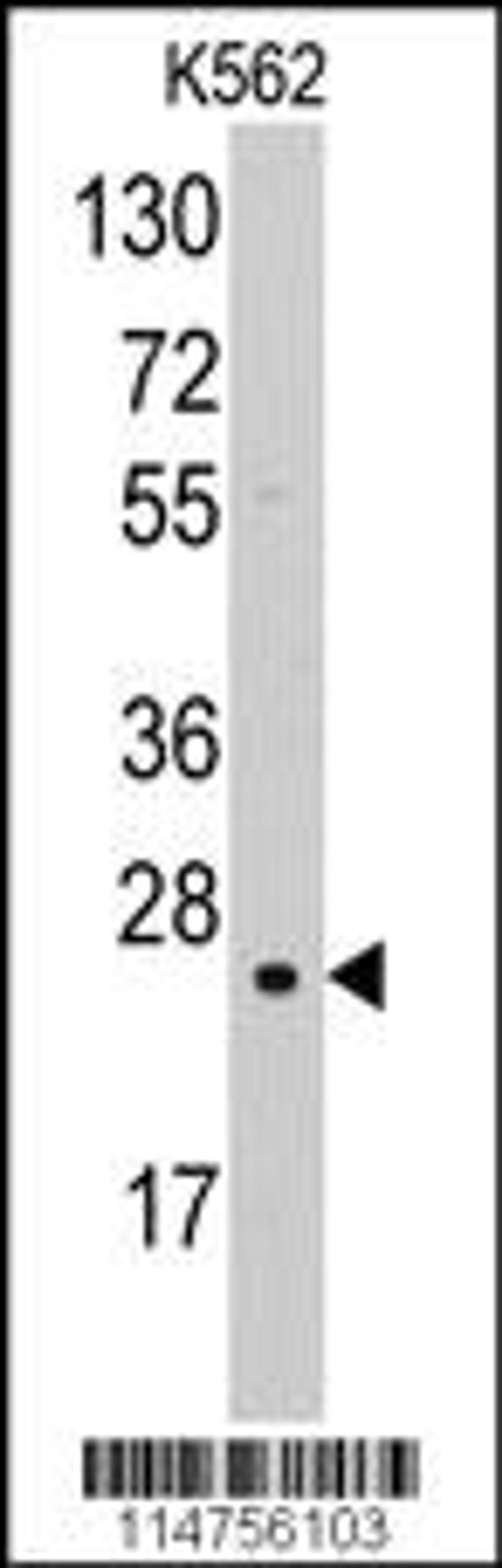 Western blot analysis of anti-SOD2 Pab in K562 cell line lysates (35ug/lane)