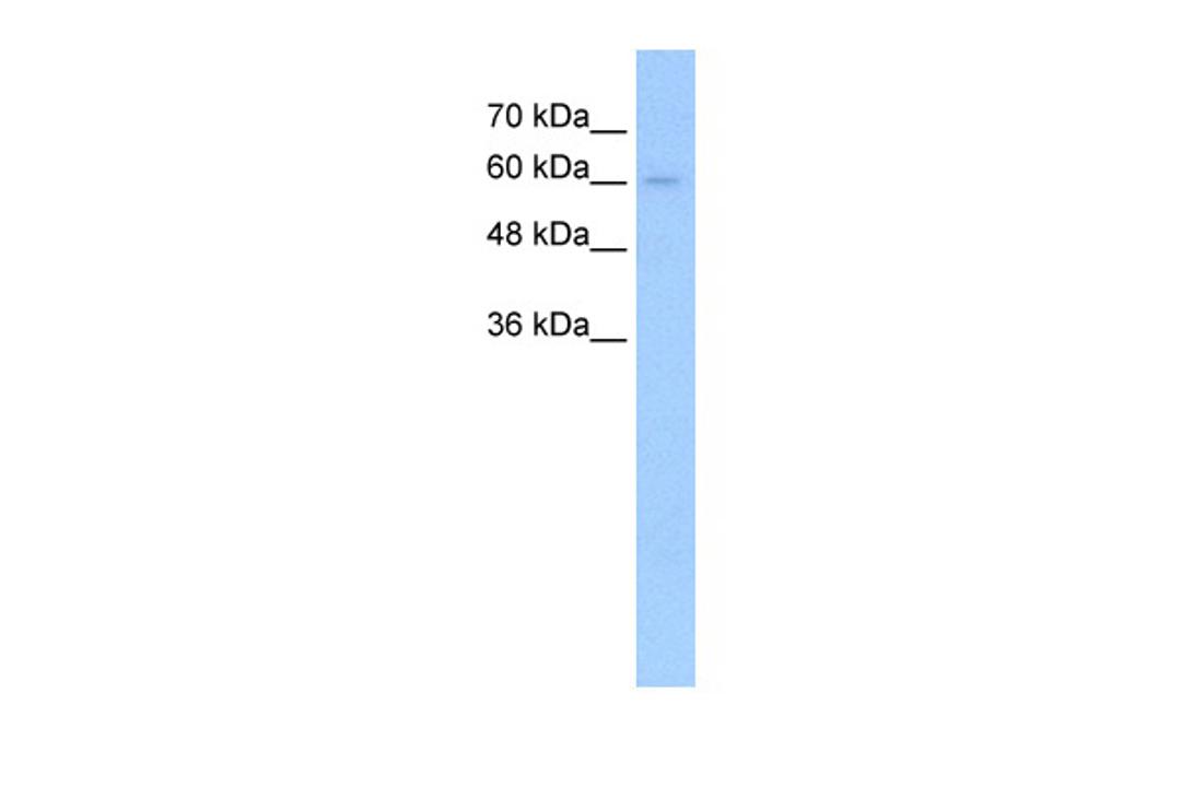 Antibody used in WB on Human HepG2 cells at 5.0 ug/ml.