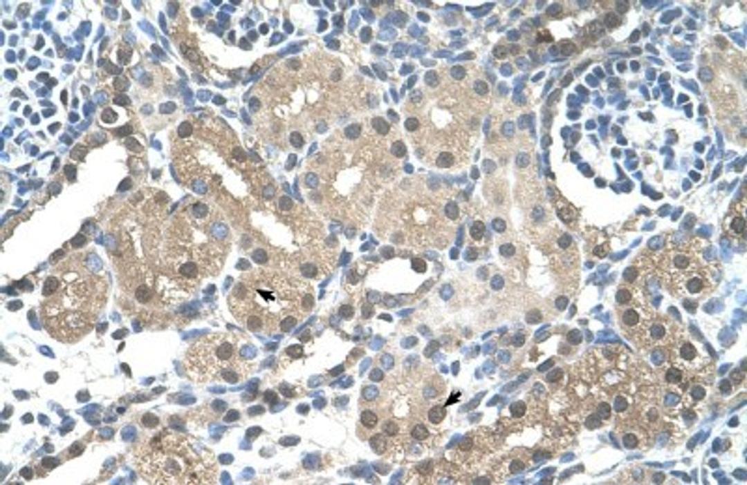 Immunohistochemistry-Paraffin: FBXL7 Antibody [NBP1-55053] - Human kidney Tissue, antibody concentration 4-8ug/ml. Cells with positive label: renal corpuscle cells (indicated with arrows) 400X magnification.