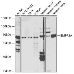 Western blot - BMPR1A antibody (A1816)