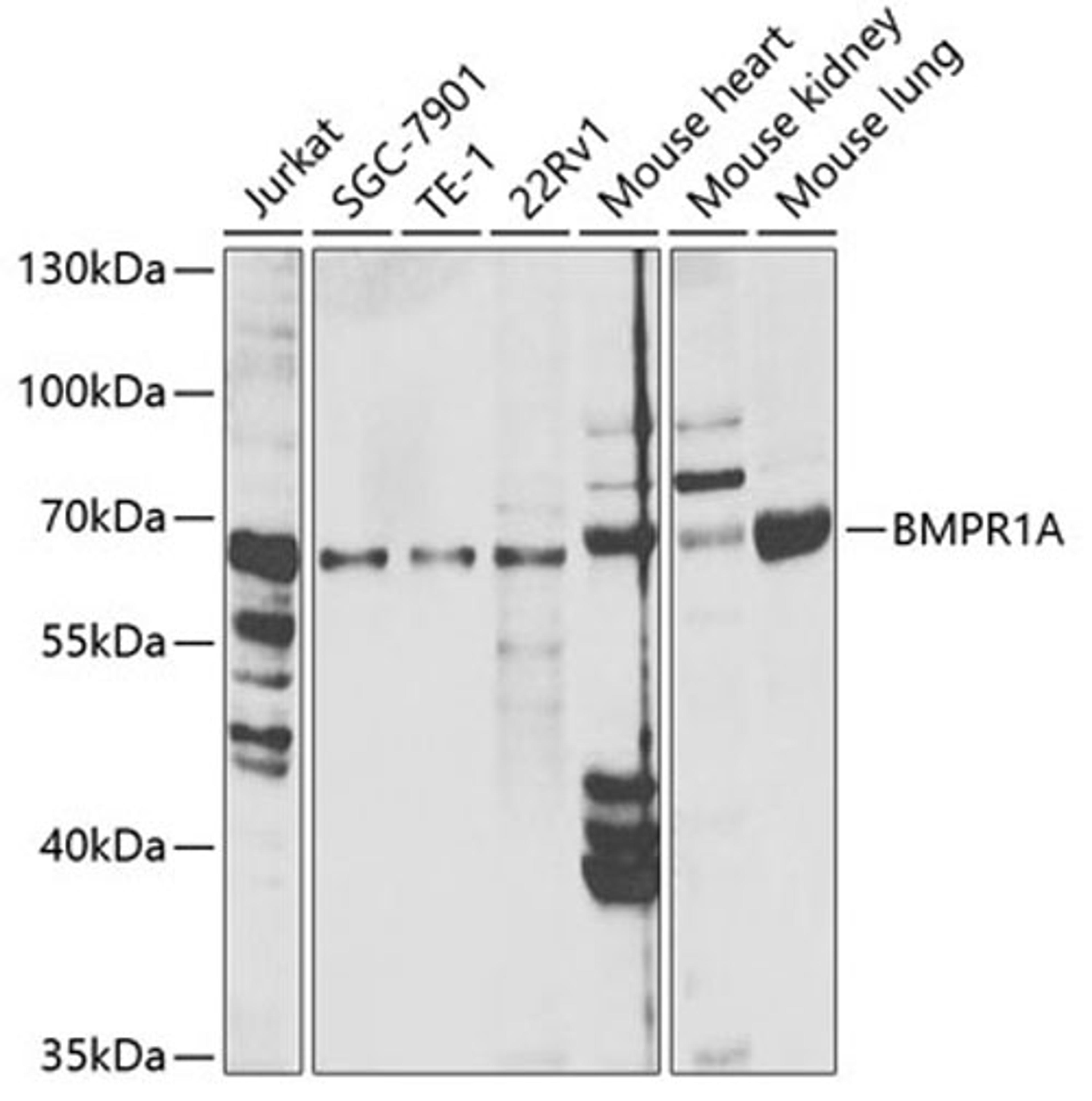 Western blot - BMPR1A antibody (A1816)