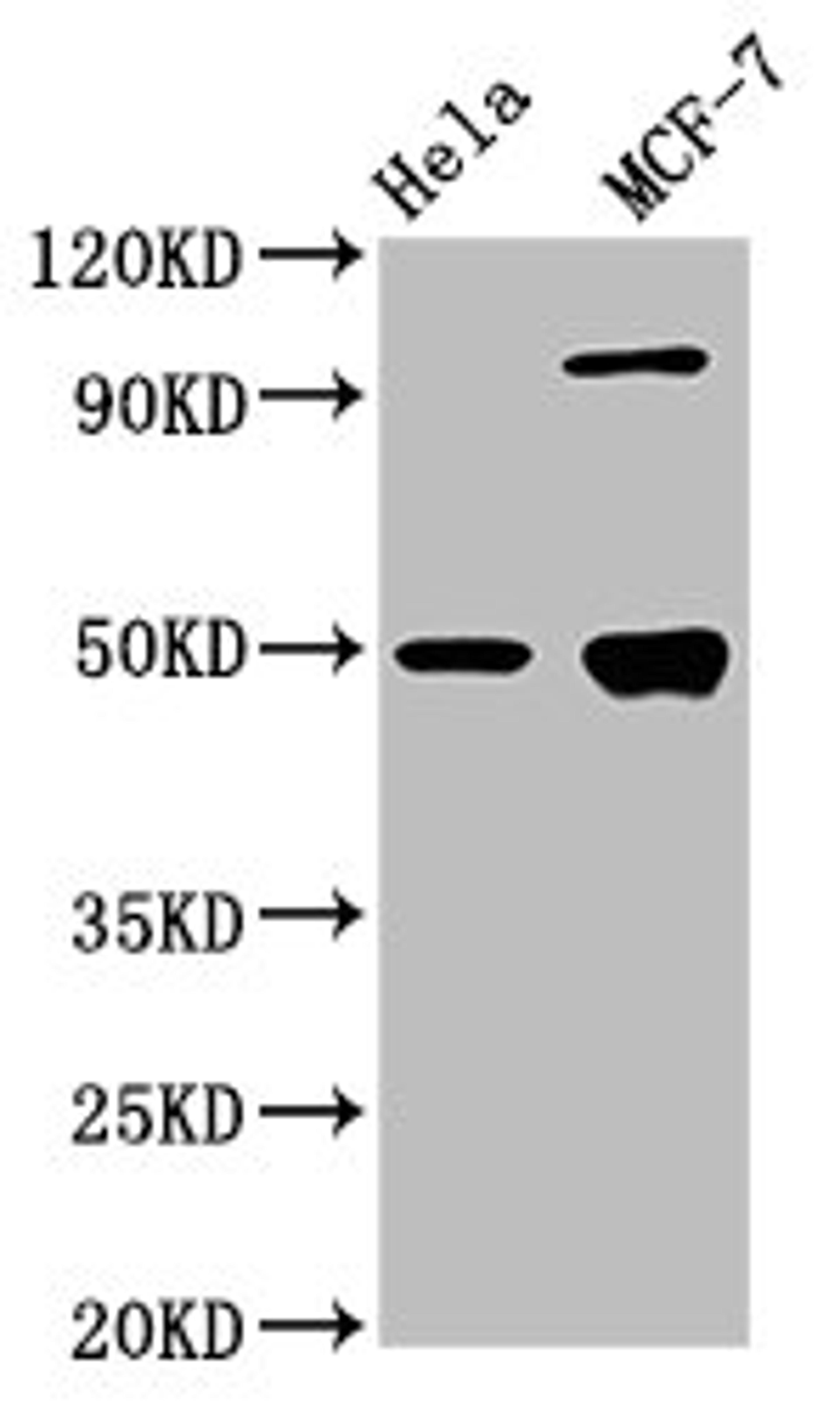 Western Blot. Positive WB detected in: Hela whole cell lysate, MCF-7 whole cell lysate. All lanes: GFAP antibody at 3.9µg/ml. Secondary. Goat polyclonal to rabbit IgG at 1/50000 dilution. Predicted band size: 50, 51 kDa. Observed band size: 50 kDa