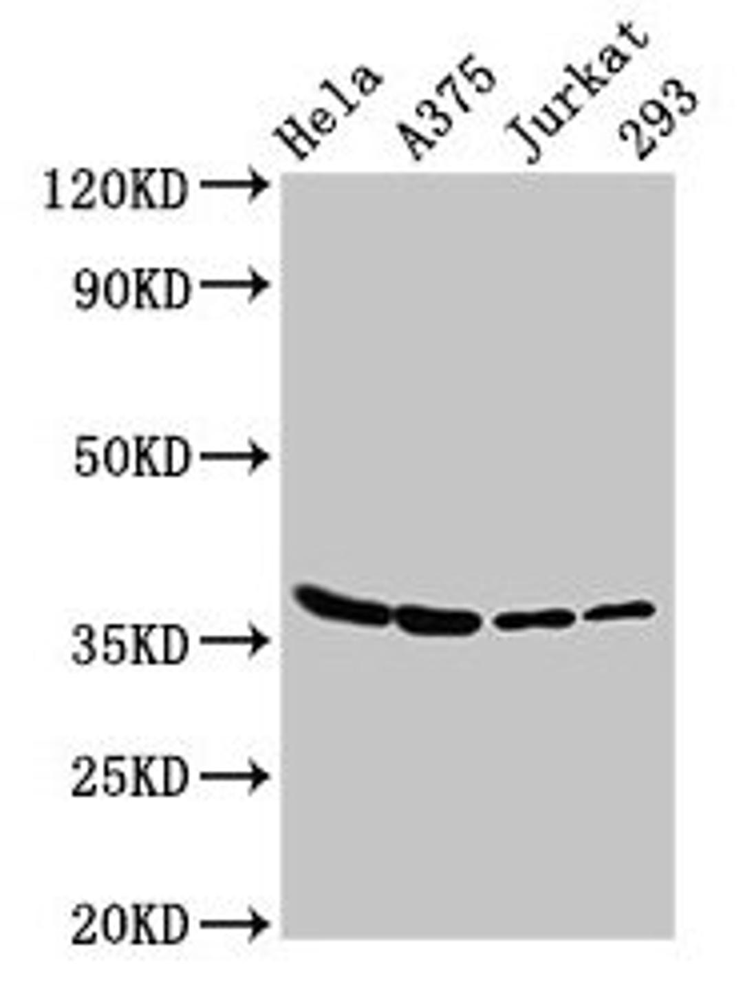 Western Blot. Positive WB detected in: Hela whole cell lysate, A375 whole cell lysate, Jurkat whole cell lysate, 293 whole cell lysate. All lanes: LDHA antibody at 3µg/ml. Secondary. Goat polyclonal to rabbit IgG at 1/50000 dilution. Predicted band size: 37, 31, 40, 27 kDa. Observed band size: 37 kDa