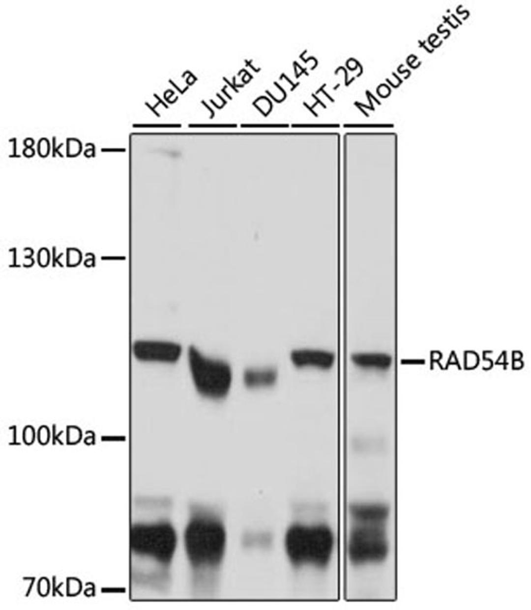 Western blot - RAD54B antibody (A16208)