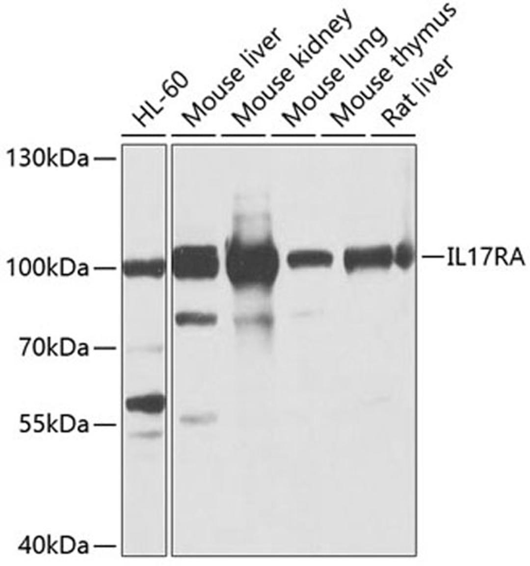 Western blot - IL17RA antibody (A10052)