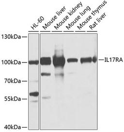 Western blot - IL17RA antibody (A10052)