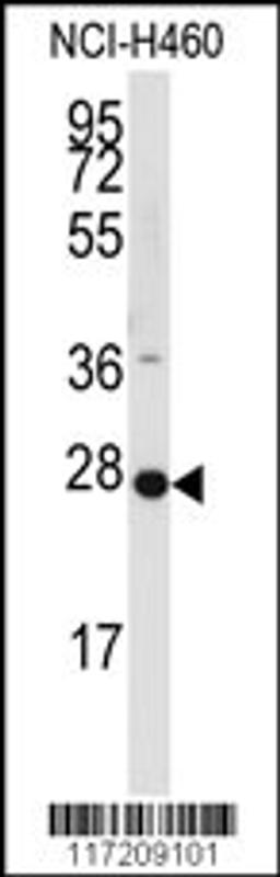 Western blot analysis of anti-PPAP2C Antibody in NCI-H460 cell line lysates (35ug/lane).