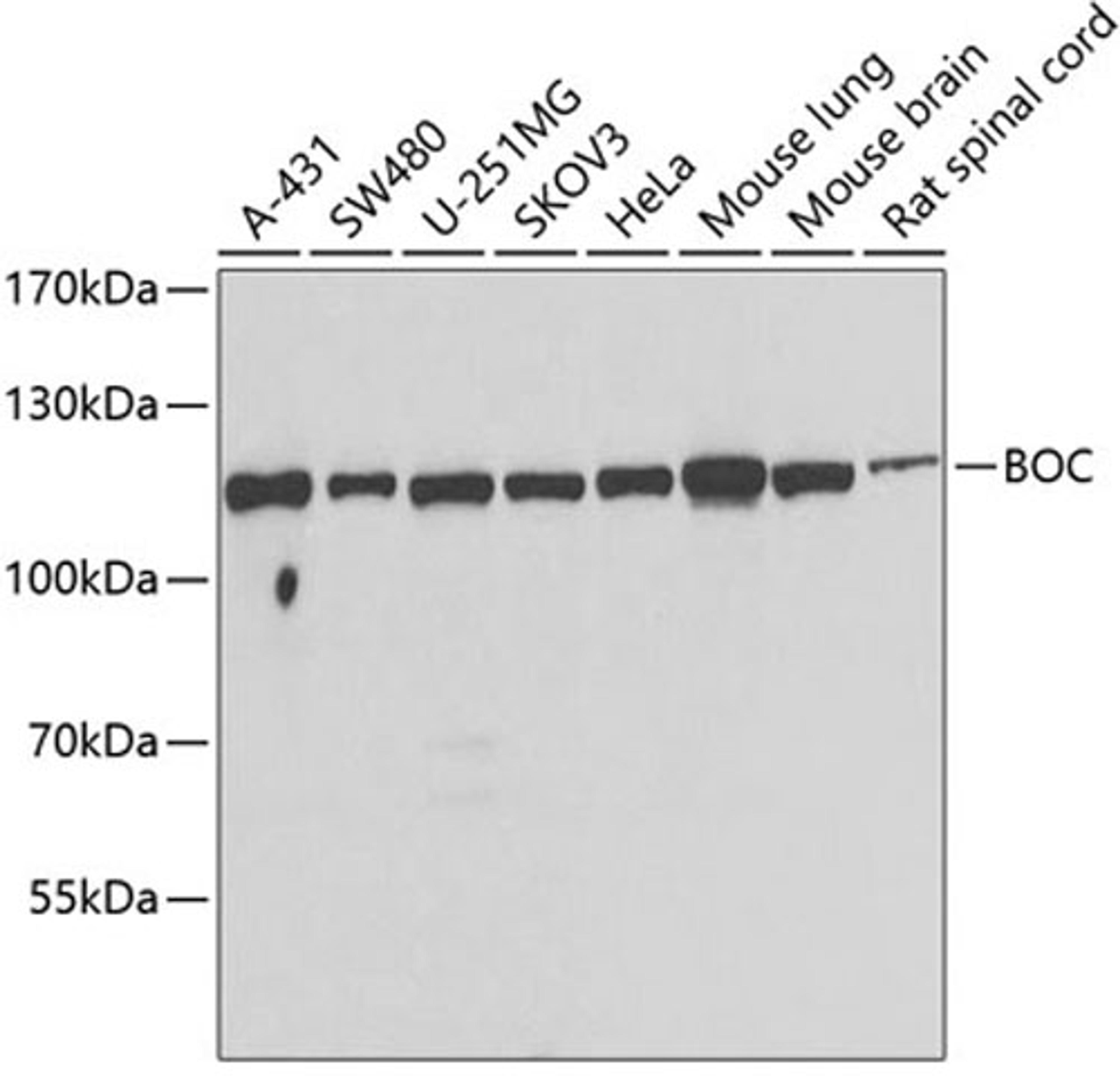 Western blot - BOC antibody (A7174)