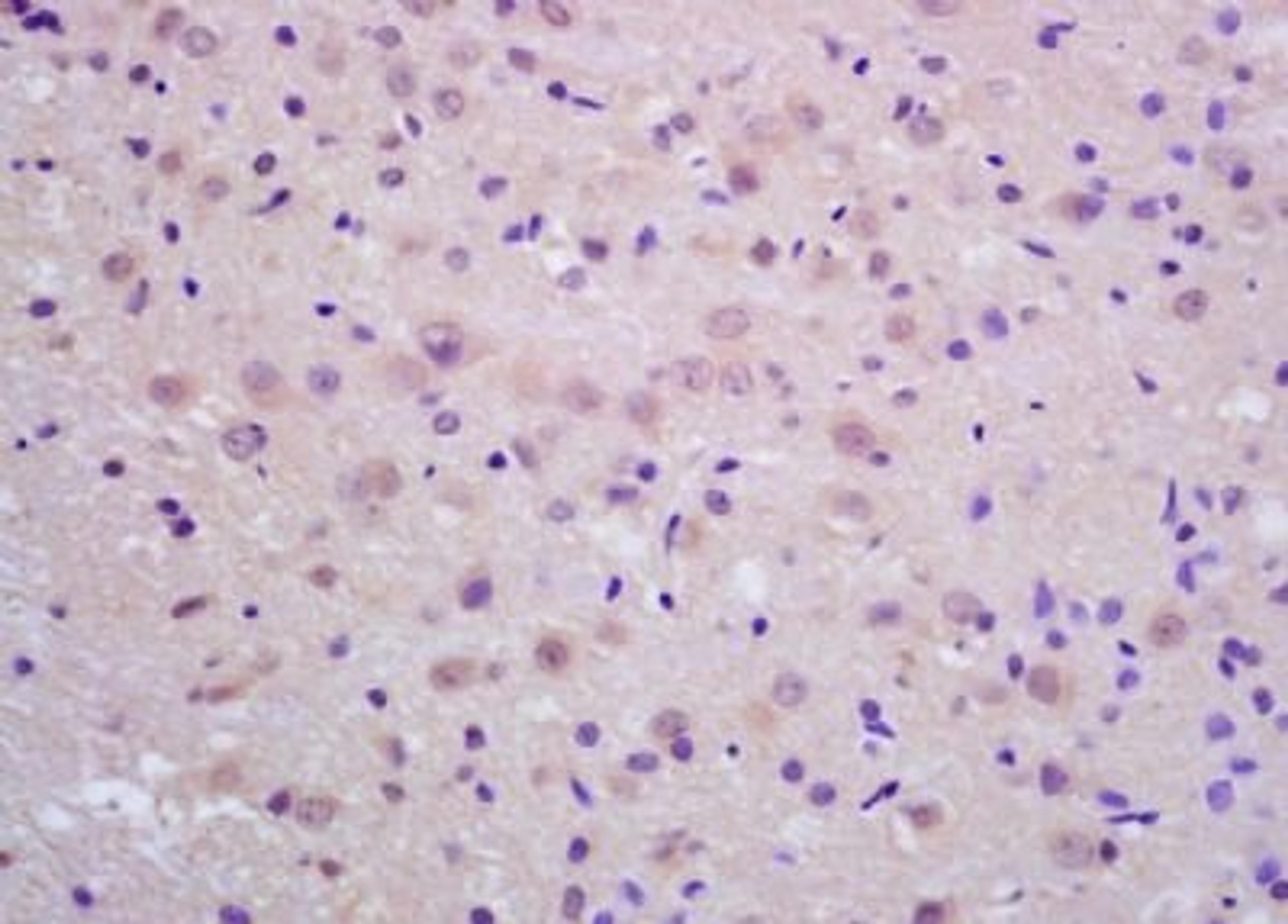 Immunohistochemical analysis of formalin-fixed paraffin embedded rat brain tissue using Neprilysin 2 antibody (dilution at 1:200)