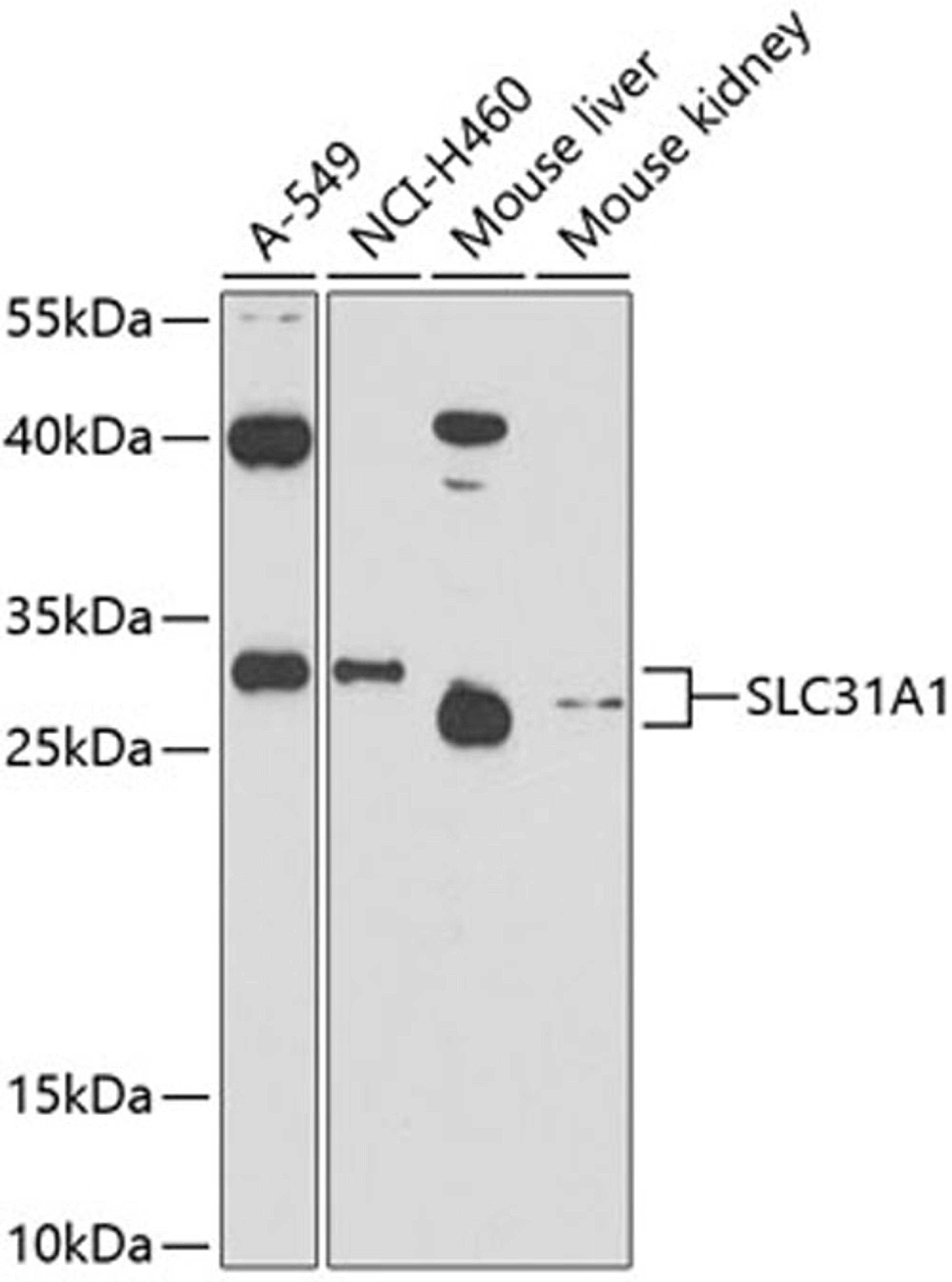 Western blot - SLC31A1 antibody (A10109)