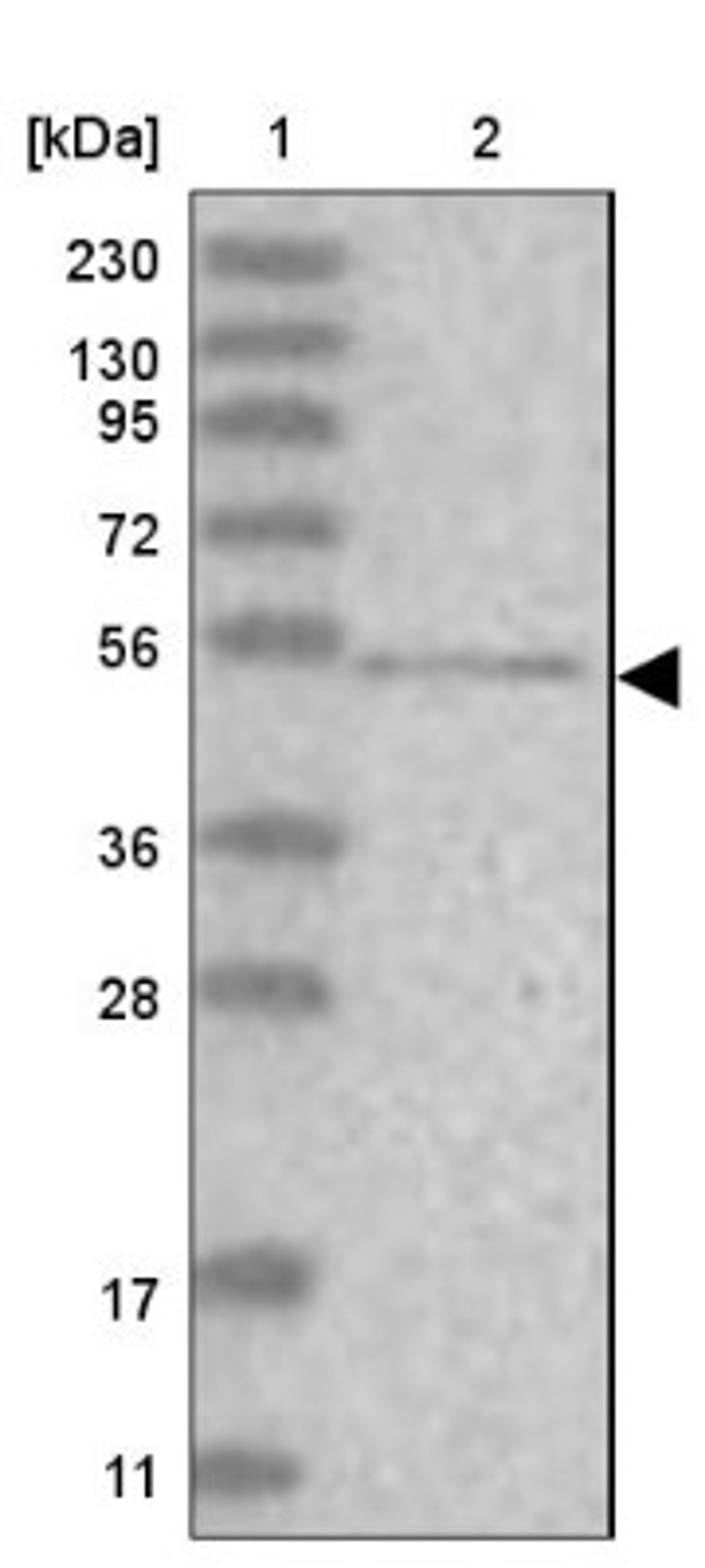 Western Blot: C1orf228 Antibody [NBP1-93486] - Lane 1: Marker [kDa] 230, 130, 95, 72, 56, 36, 28, 17, 11<br/>Lane 2: Human cell line RT-4