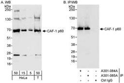 Detection of human CAF-1 p60 by western blot and immunoprecipitation.