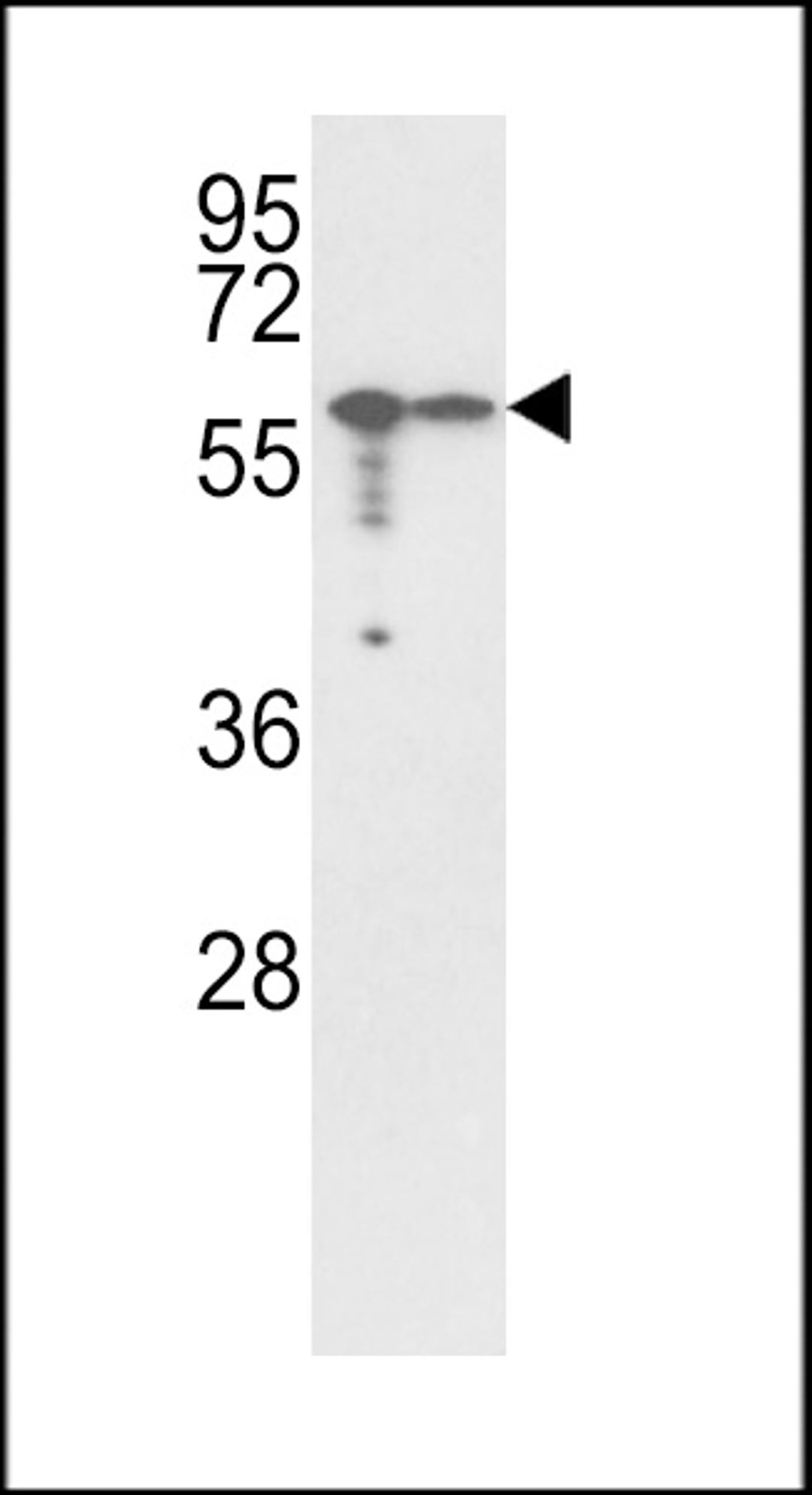 Western blot analysis of Vimentin Antibody in A2058,A375 cell line lysates (35ug/lane)