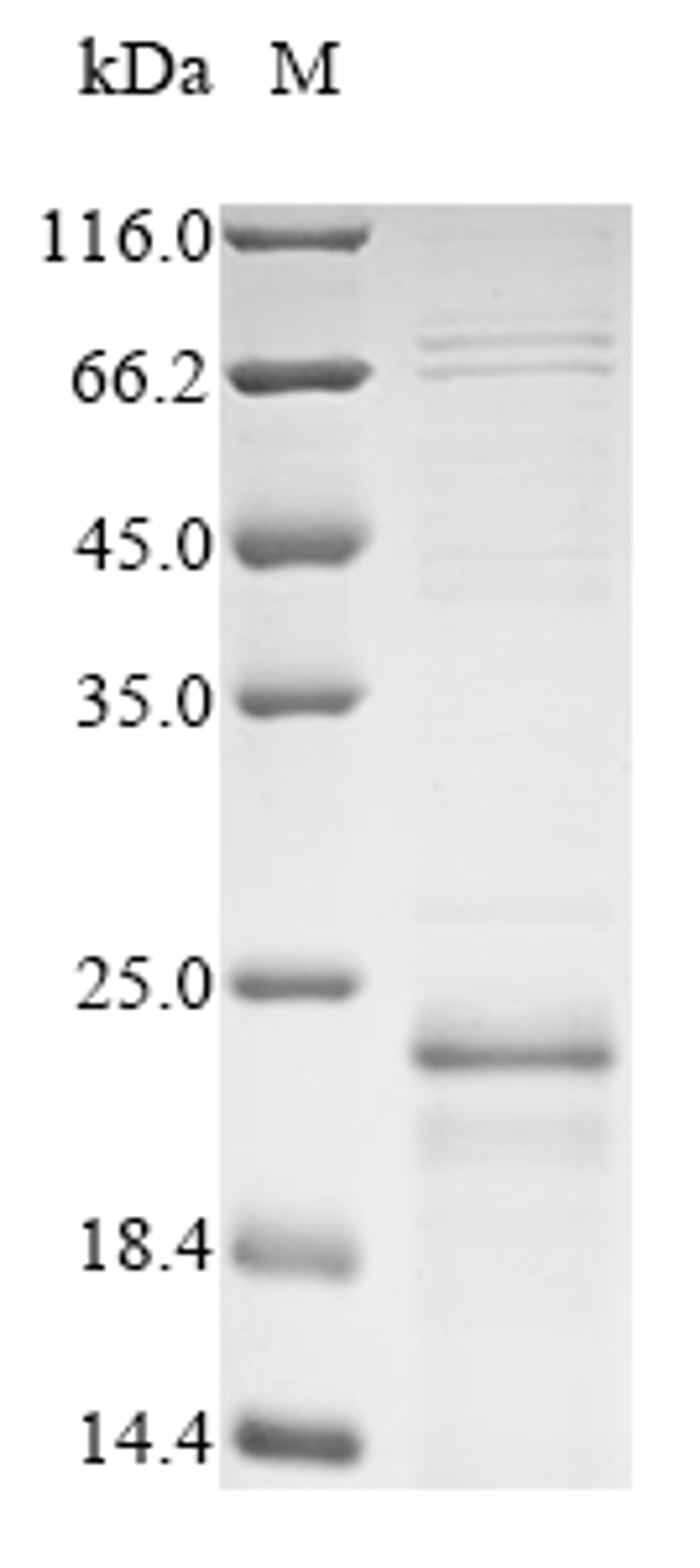 (Tris-Glycine gel) Discontinuous SDS-PAGE (reduced) with 5% enrichment gel and 15% separation gel.