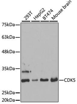 Western blot - CDK5 antibody (A5730)