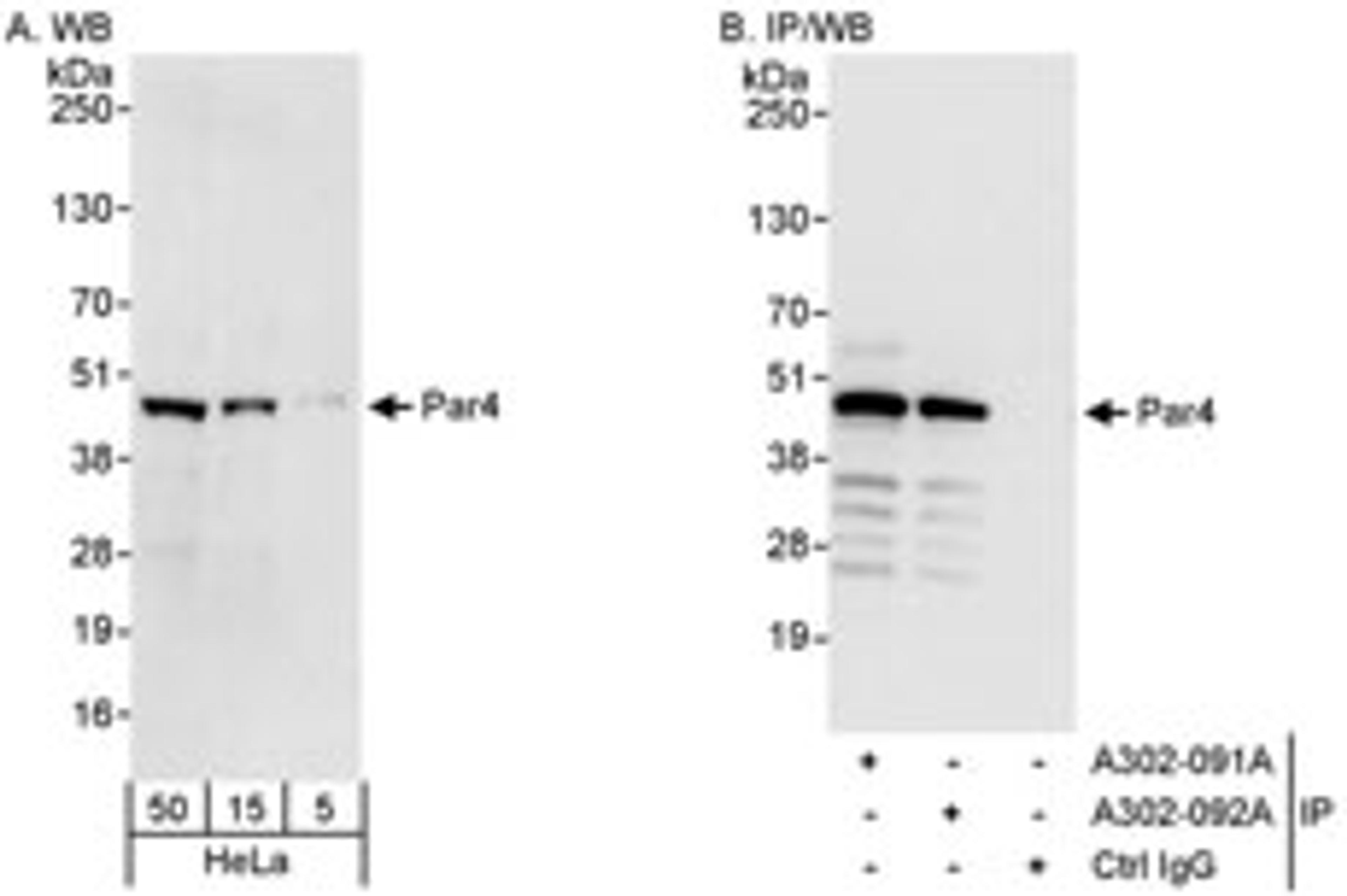 Detection of human Par4 by western blot and immunoprecipitation.