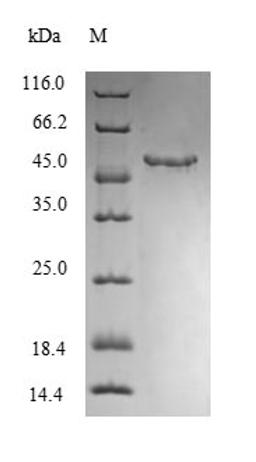 (Tris-Glycine gel) Discontinuous SDS-PAGE (reduced) with 5% enrichment gel and 15% separation gel.