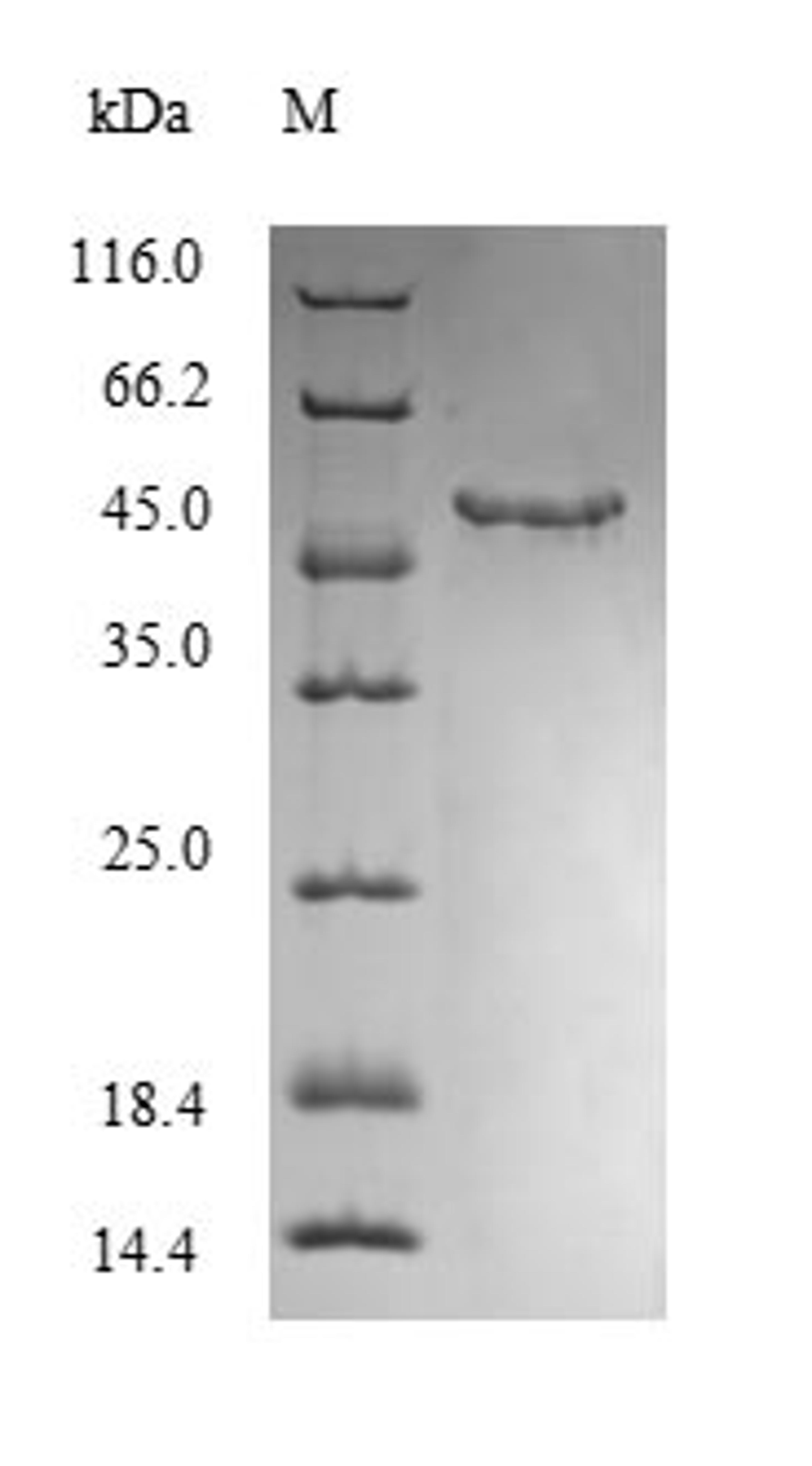 (Tris-Glycine gel) Discontinuous SDS-PAGE (reduced) with 5% enrichment gel and 15% separation gel.