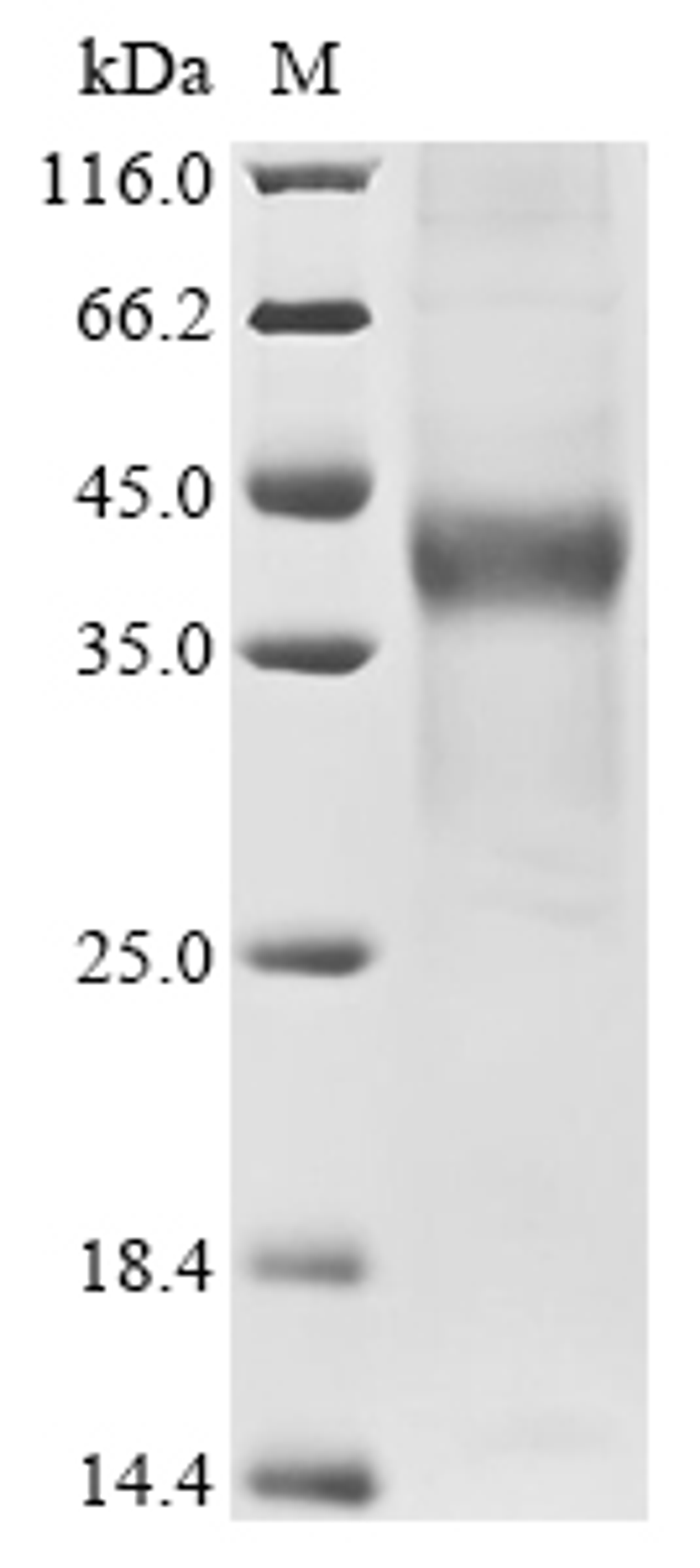 (Tris-Glycine gel) Discontinuous SDS-PAGE (reduced) with 5% enrichment gel and 15% separation gel.
