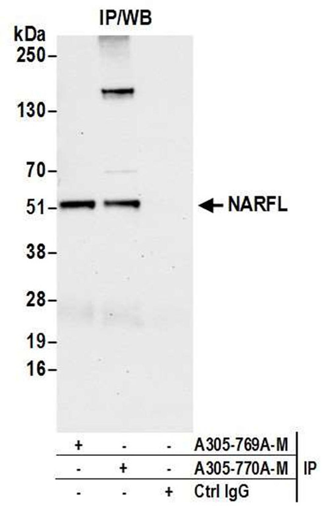 Detection of Human NARFL by WB of IP.