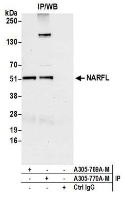 Detection of Human NARFL by WB of IP.