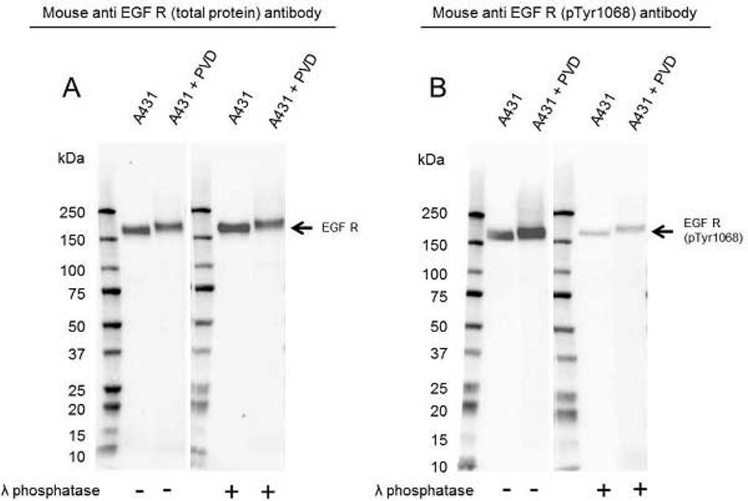 Western Blot analysis of A431 untreated and pervanadate whole cell lysates 