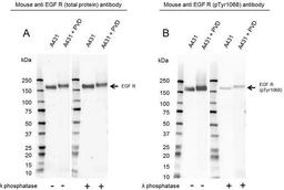 Western Blot analysis of A431 untreated and pervanadate whole cell lysates 