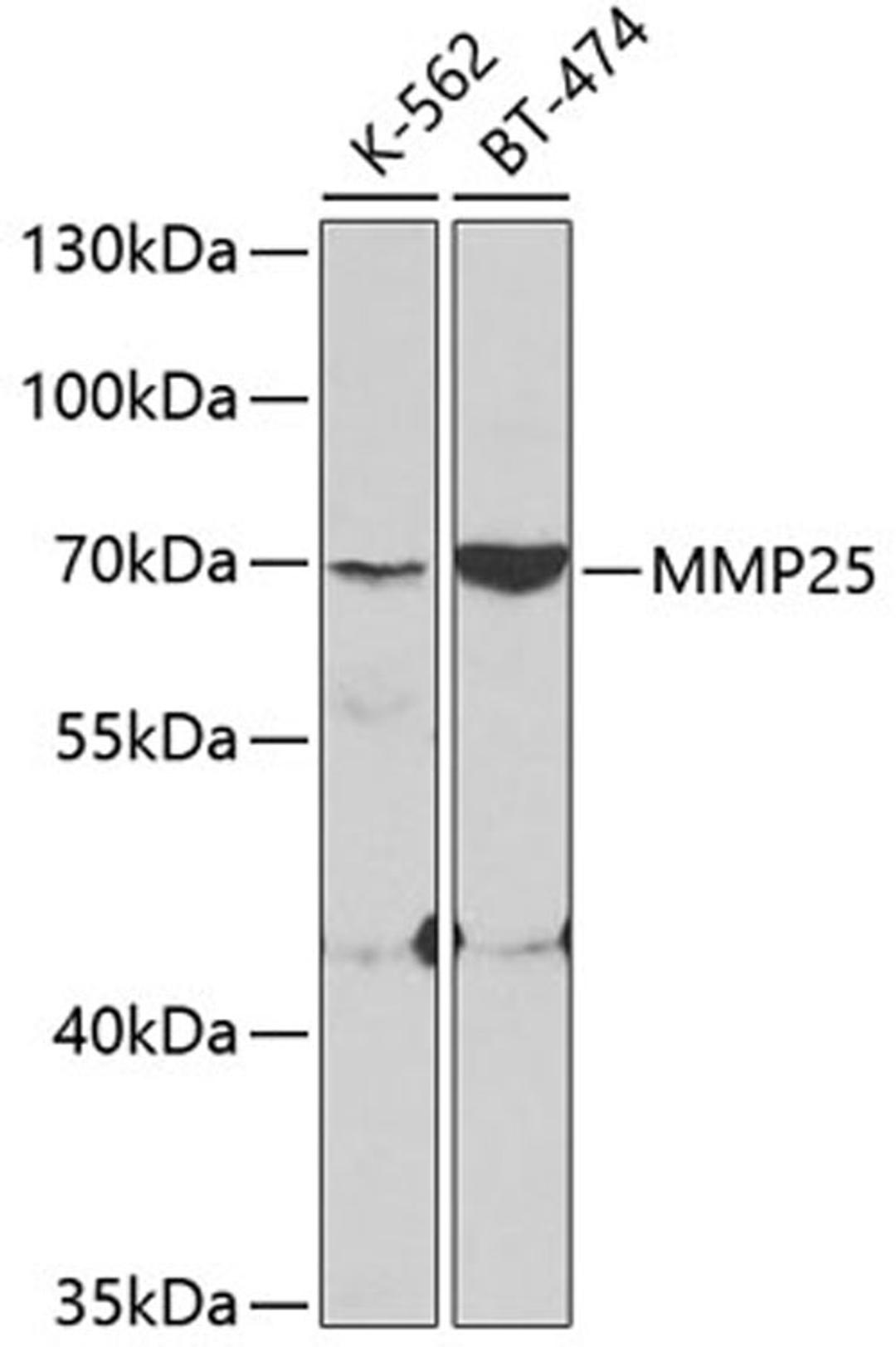 Western blot - MMP25 antibody (A3032)
