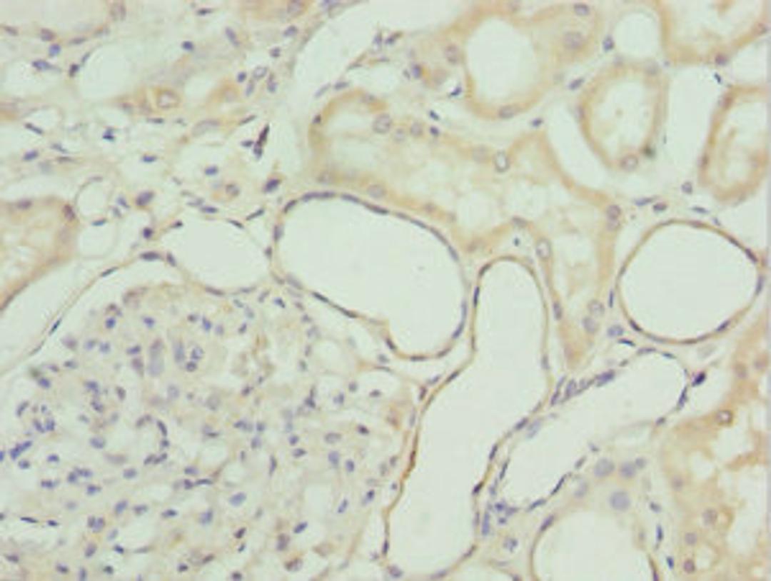 Immunohistochemistry of paraffin-embedded human kidney tissue using CSB-PA010083ESR2HU at dilution of 1:100