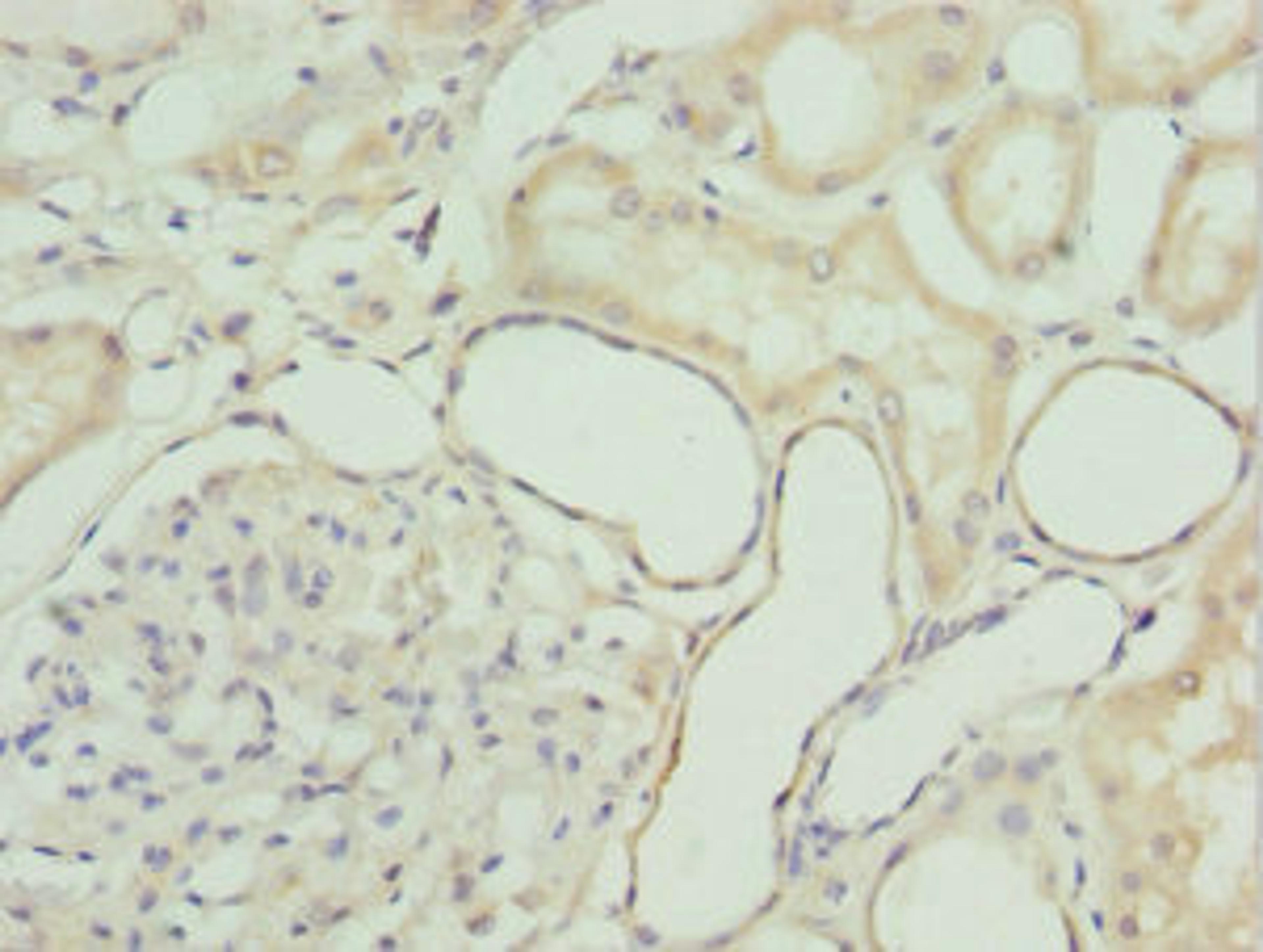 Immunohistochemistry of paraffin-embedded human kidney tissue using CSB-PA010083ESR2HU at dilution of 1:100