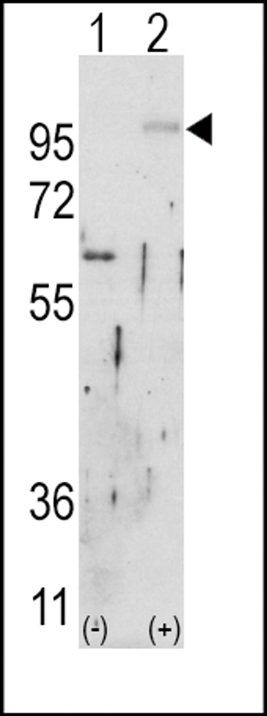 Western blot analysis of FGFR2 using rabbit polyclonal FGFR2 Antibody using 293 cell lysates (2 ug/lane) either nontransfected (Lane 1) or transiently transfected with the FGFR2 gene (Lane 2).