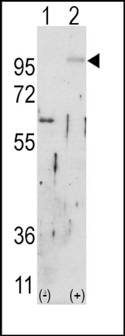 Western blot analysis of FGFR2 using rabbit polyclonal FGFR2 Antibody using 293 cell lysates (2 ug/lane) either nontransfected (Lane 1) or transiently transfected with the FGFR2 gene (Lane 2).