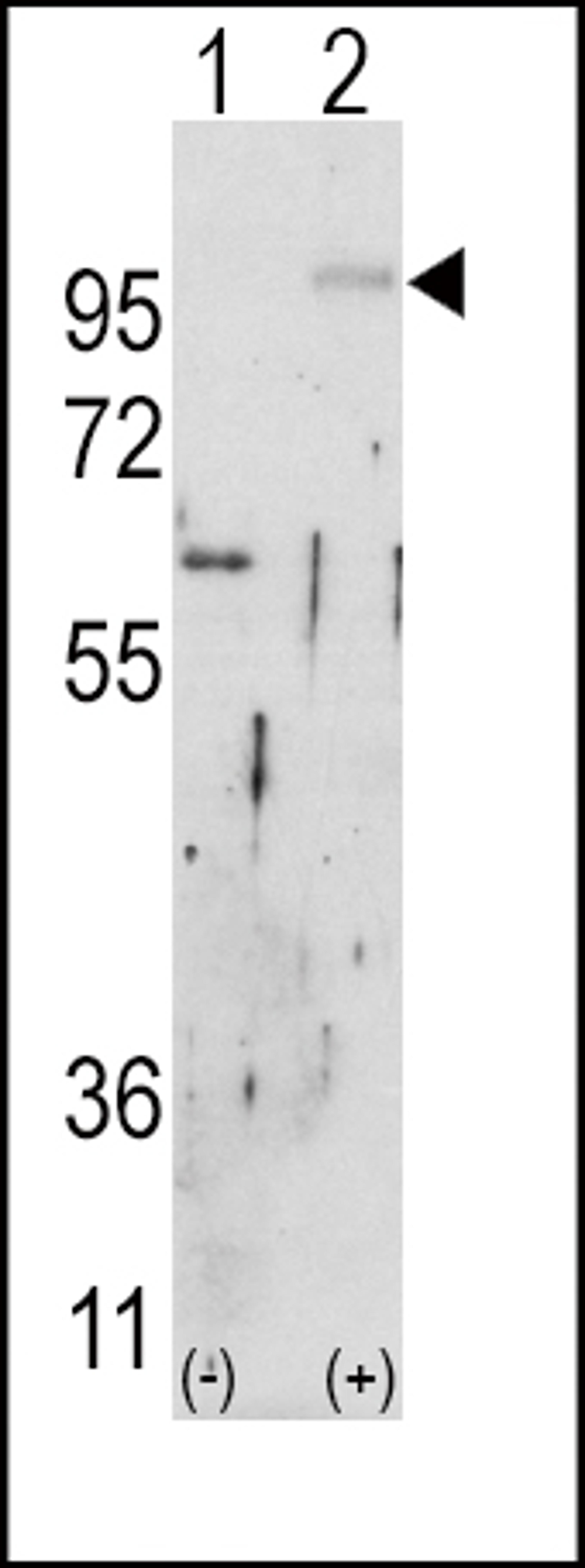 Western blot analysis of FGFR2 using rabbit polyclonal FGFR2 Antibody using 293 cell lysates (2 ug/lane) either nontransfected (Lane 1) or transiently transfected with the FGFR2 gene (Lane 2).