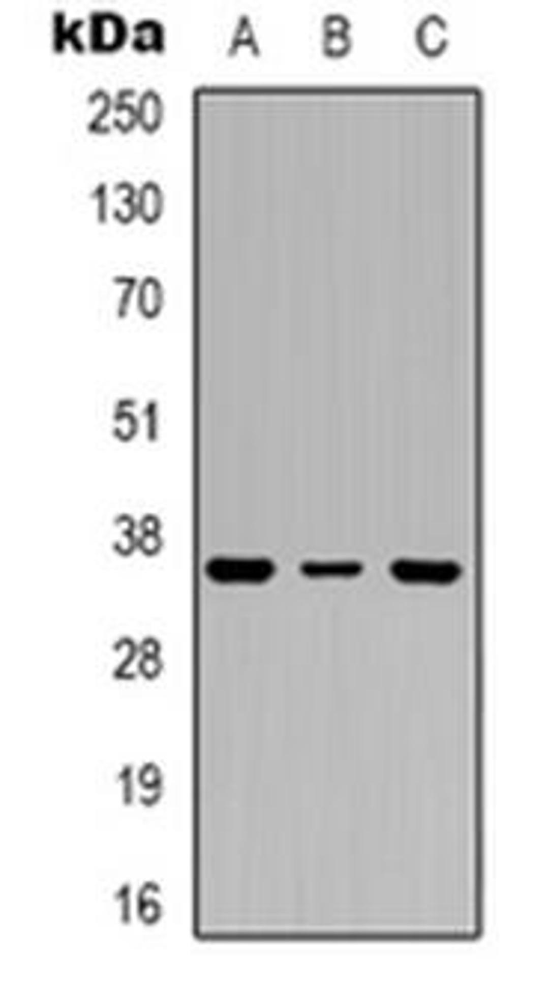 Western blot analysis of PIG3 expression in A549 (Lane 1), MCF7 (Lane 2), HepG2 (Lane 3) whole cell lysates using TP53I3 antibody