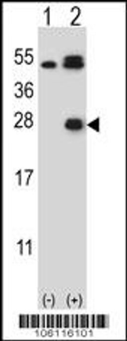 Western blot analysis of KLK6 using rabbit polyclonal KLK6 Antibody (L141) using 293 cell lysates (2 ug/lane) either nontransfected (Lane 1) or transiently transfected (Lane 2) with the KLK6 gene.