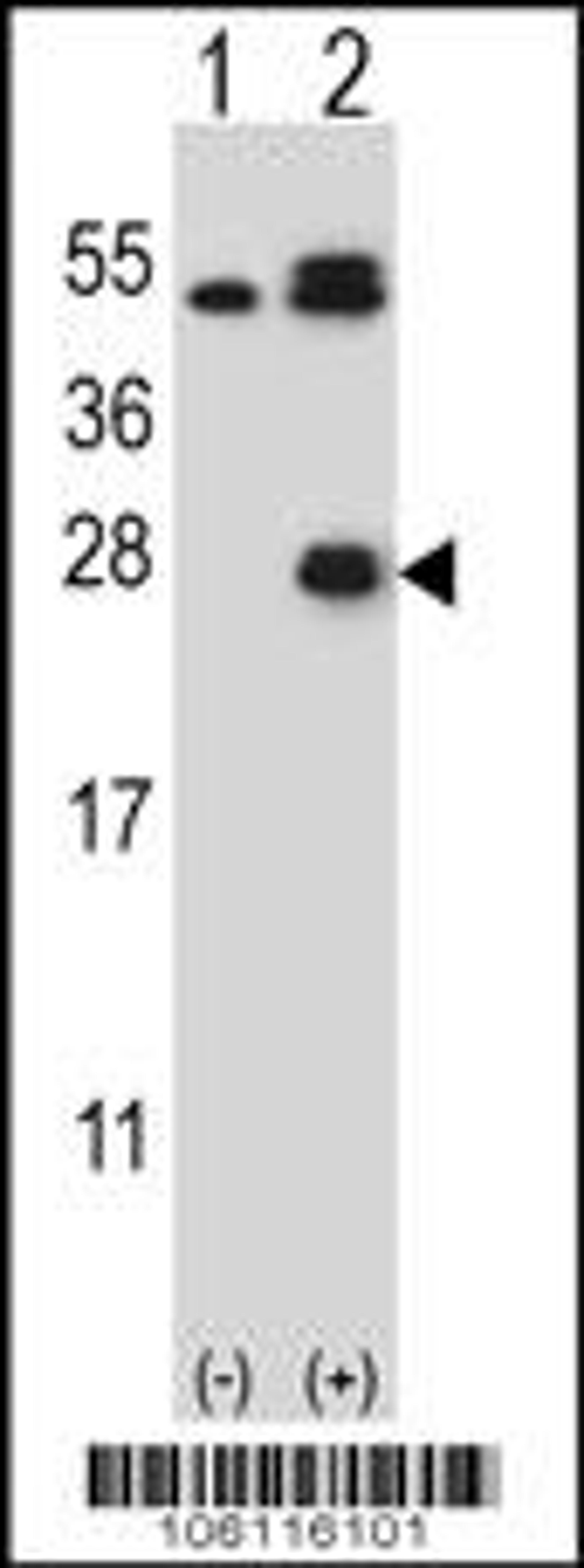 Western blot analysis of KLK6 using rabbit polyclonal KLK6 Antibody (L141) using 293 cell lysates (2 ug/lane) either nontransfected (Lane 1) or transiently transfected (Lane 2) with the KLK6 gene.