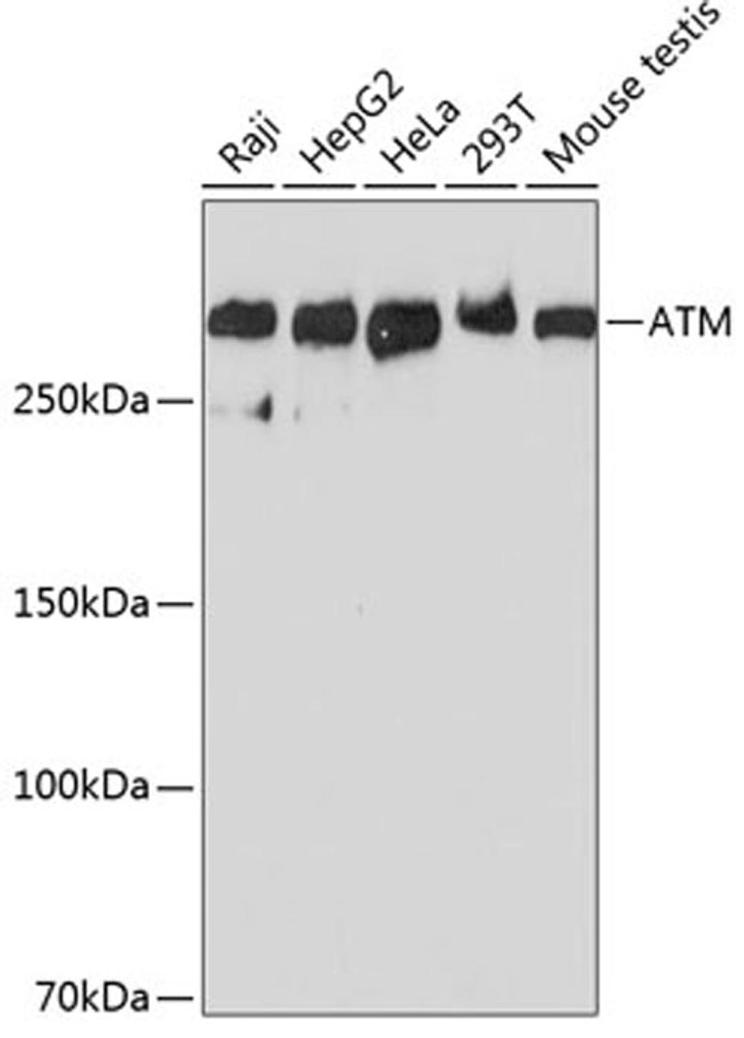 Western blot - ATM antibody (A19650)