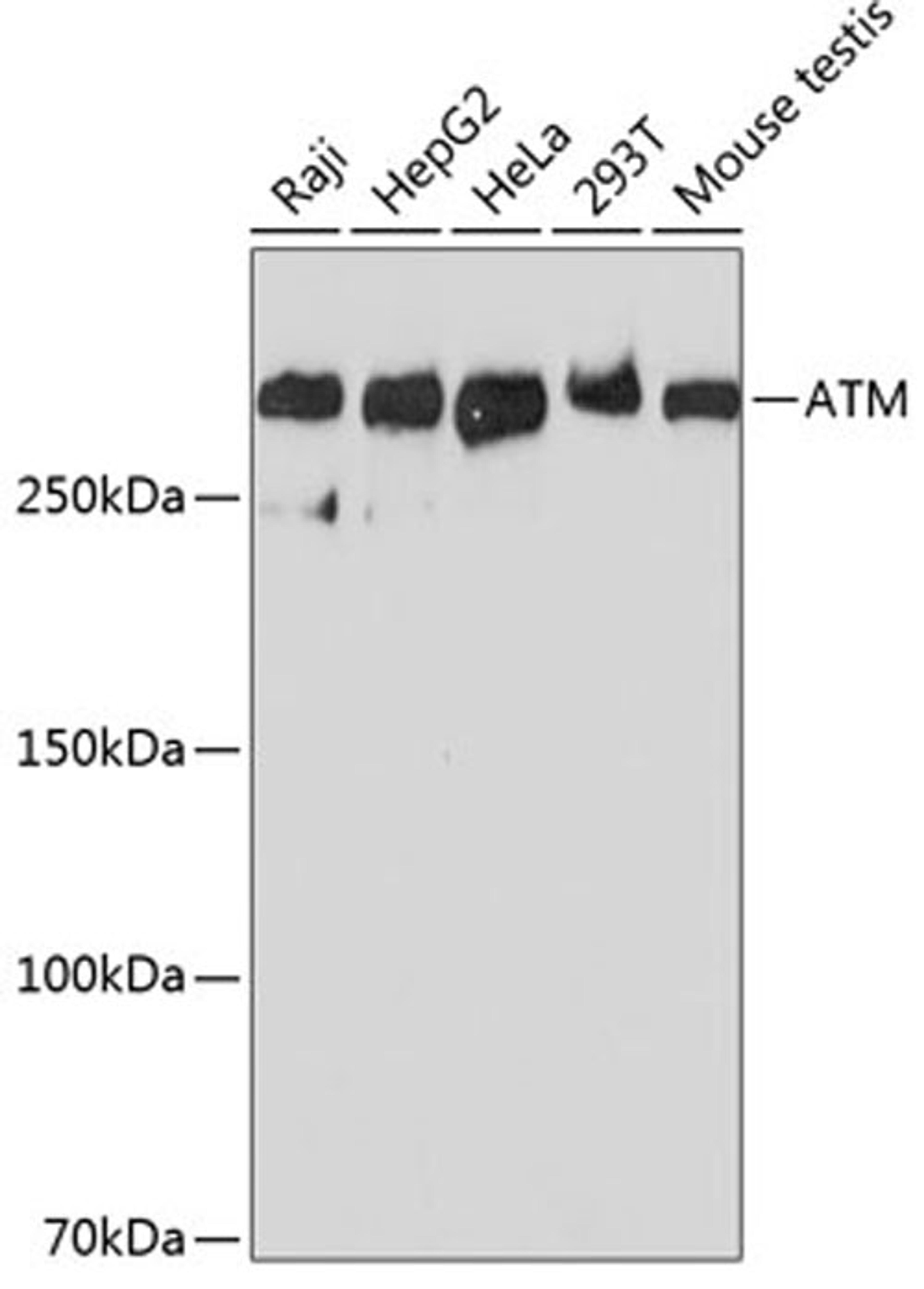 Western blot - ATM antibody (A19650)