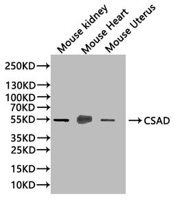 Western blot. All lanes: Csad antibody at 12µg/ml + NIH/3T3 whole cell lysate. Secondary. Goat polyclonal to rabbit IgG at 1/10000 dilution. Predicted band size: 56 kDa. Observed band size: 56 kDa