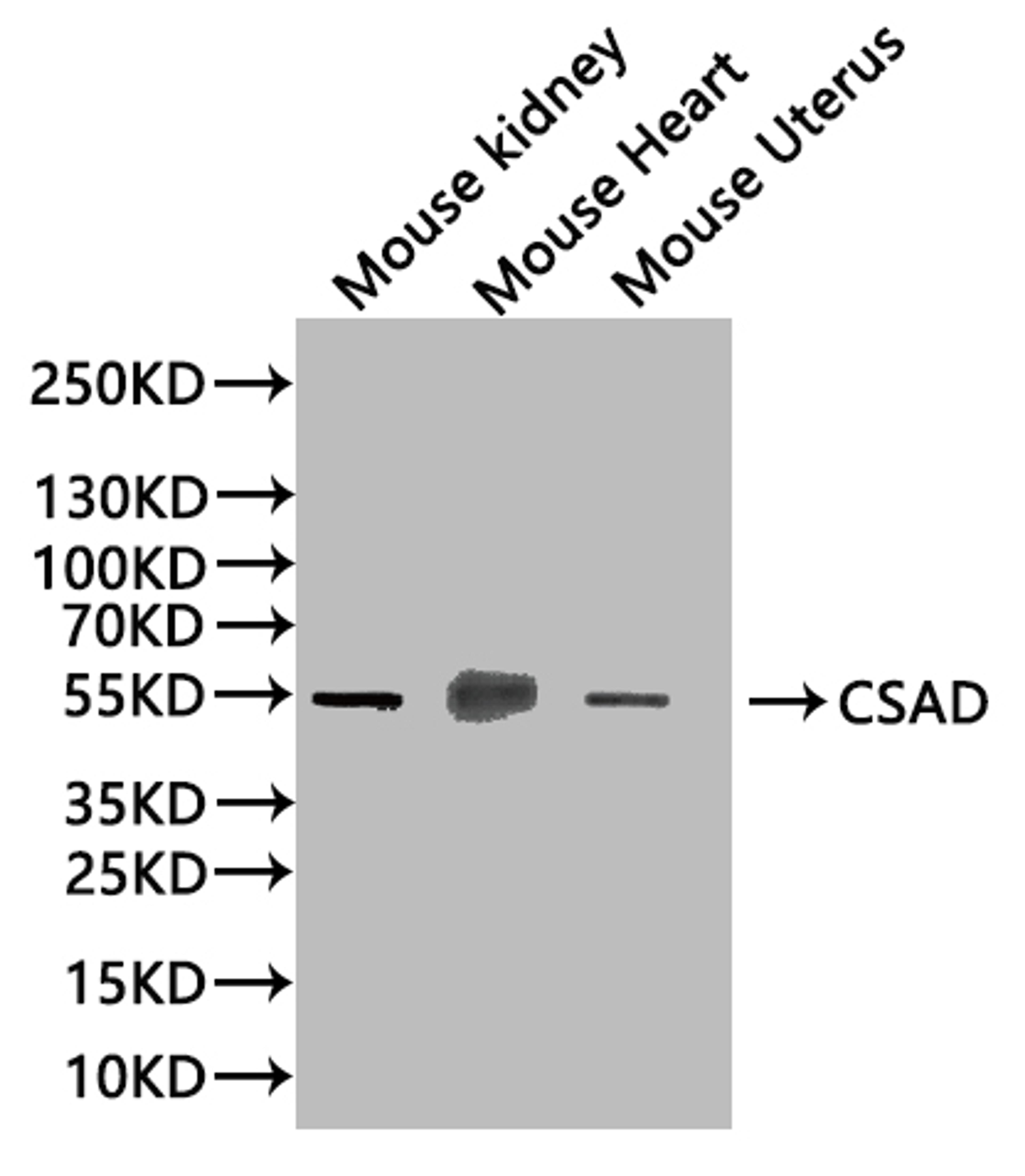 Western blot. All lanes: Csad antibody at 12µg/ml + NIH/3T3 whole cell lysate. Secondary. Goat polyclonal to rabbit IgG at 1/10000 dilution. Predicted band size: 56 kDa. Observed band size: 56 kDa
