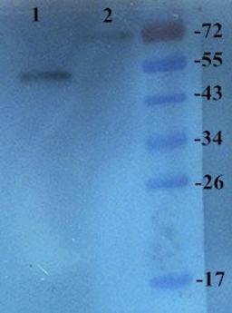 Western blot analysis of rat kidney (Lane 1), liver (Lane 2) using ASGR1 antibody (primary antibody at 1:200)