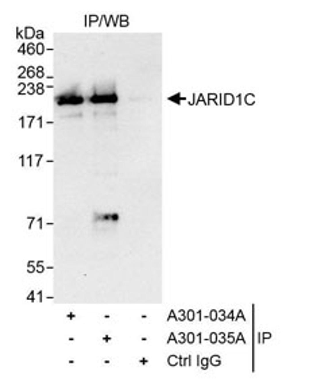 Detection of human JARID1C by western blot of immunoprecipitates.