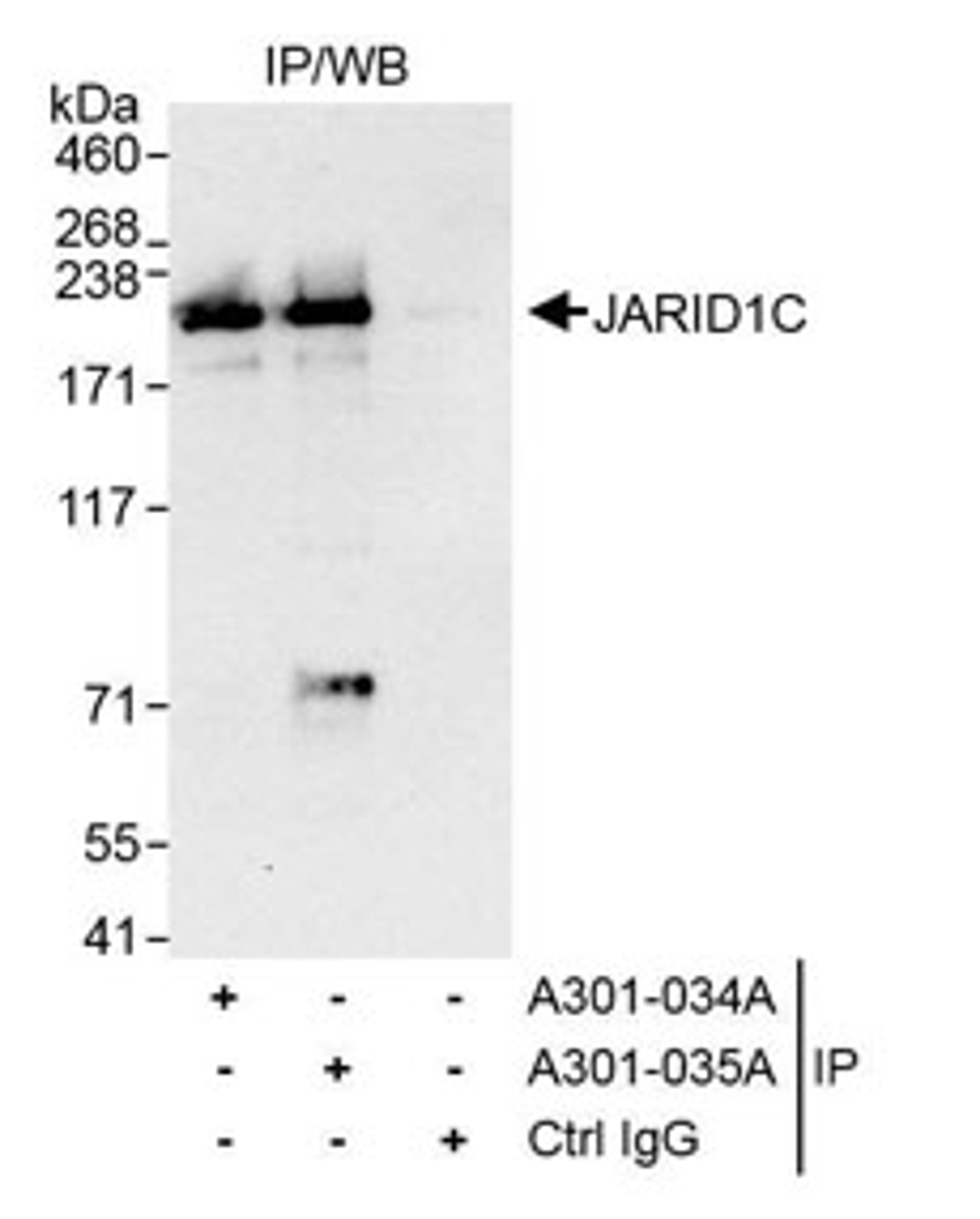 Detection of human JARID1C by western blot of immunoprecipitates.