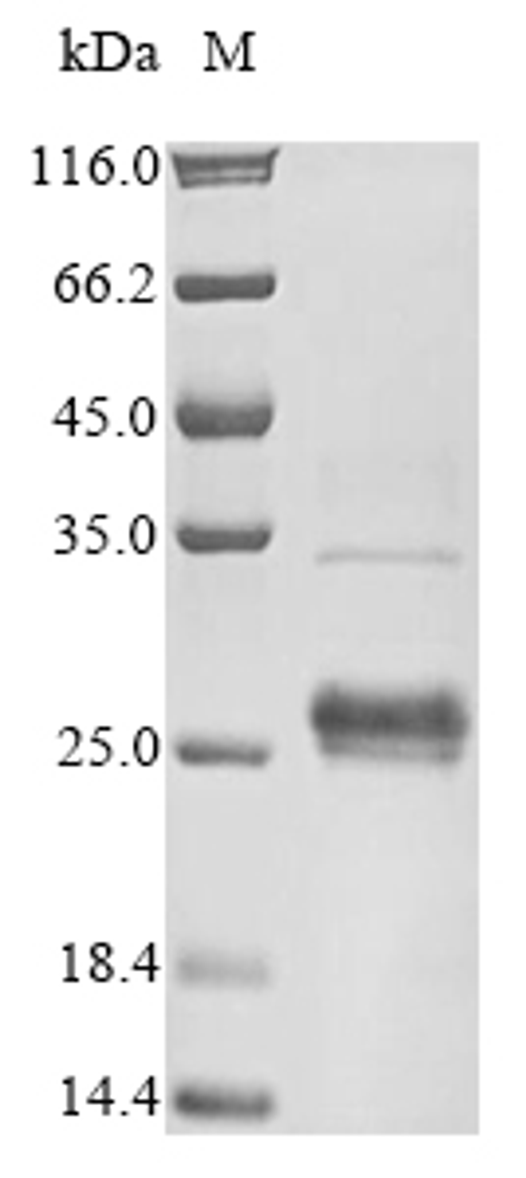 (Tris-Glycine gel) Discontinuous SDS-PAGE (reduced) with 5% enrichment gel and 15% separation gel.
