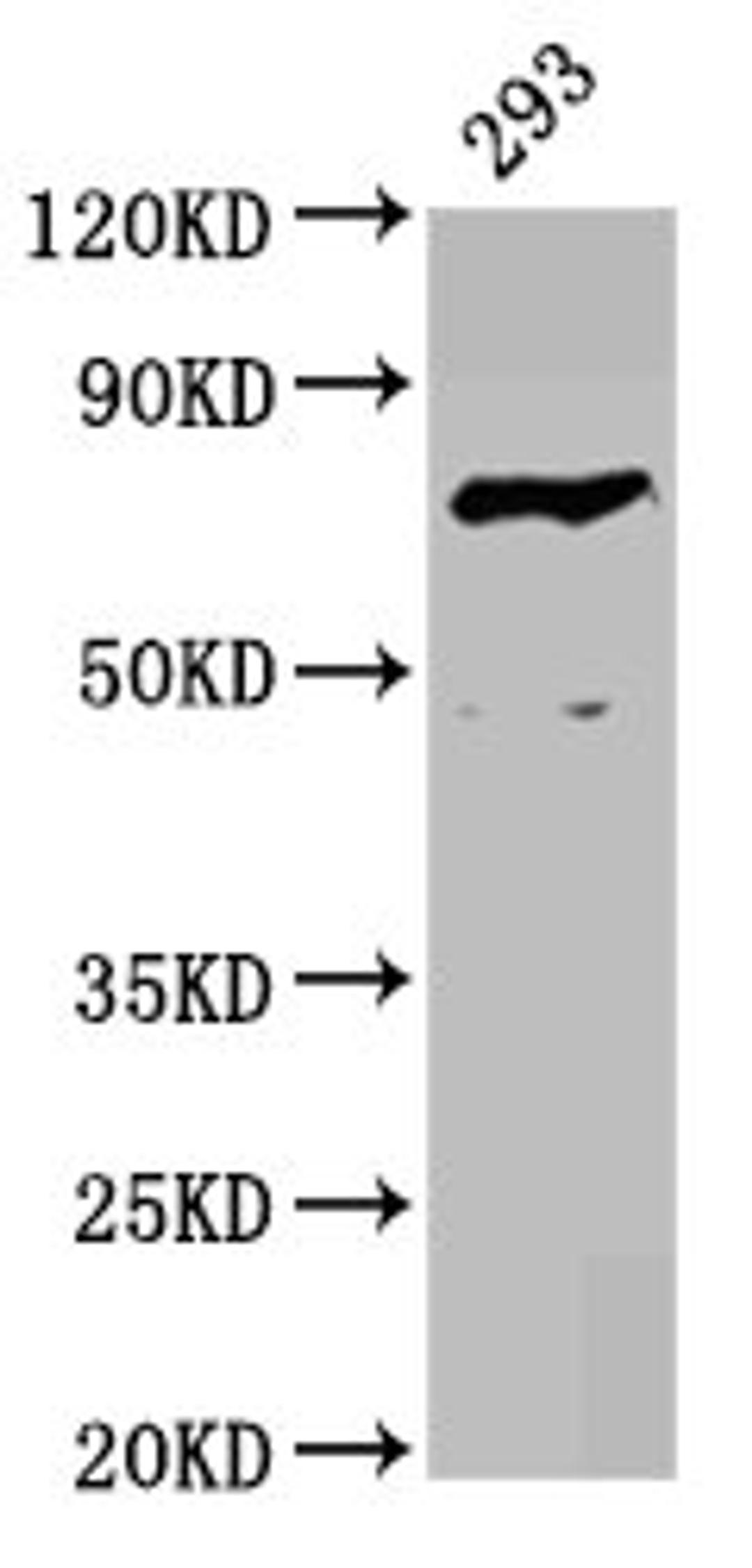 Western Blot. Positive WB detected in: 293 whole cell lysate. All lanes: F13B antibody at 4.17µg/ml. Secondary. Goat polyclonal to rabbit IgG at 1/50000 dilution. Predicted band size: 76 kDa. Observed band size: 76 kDa