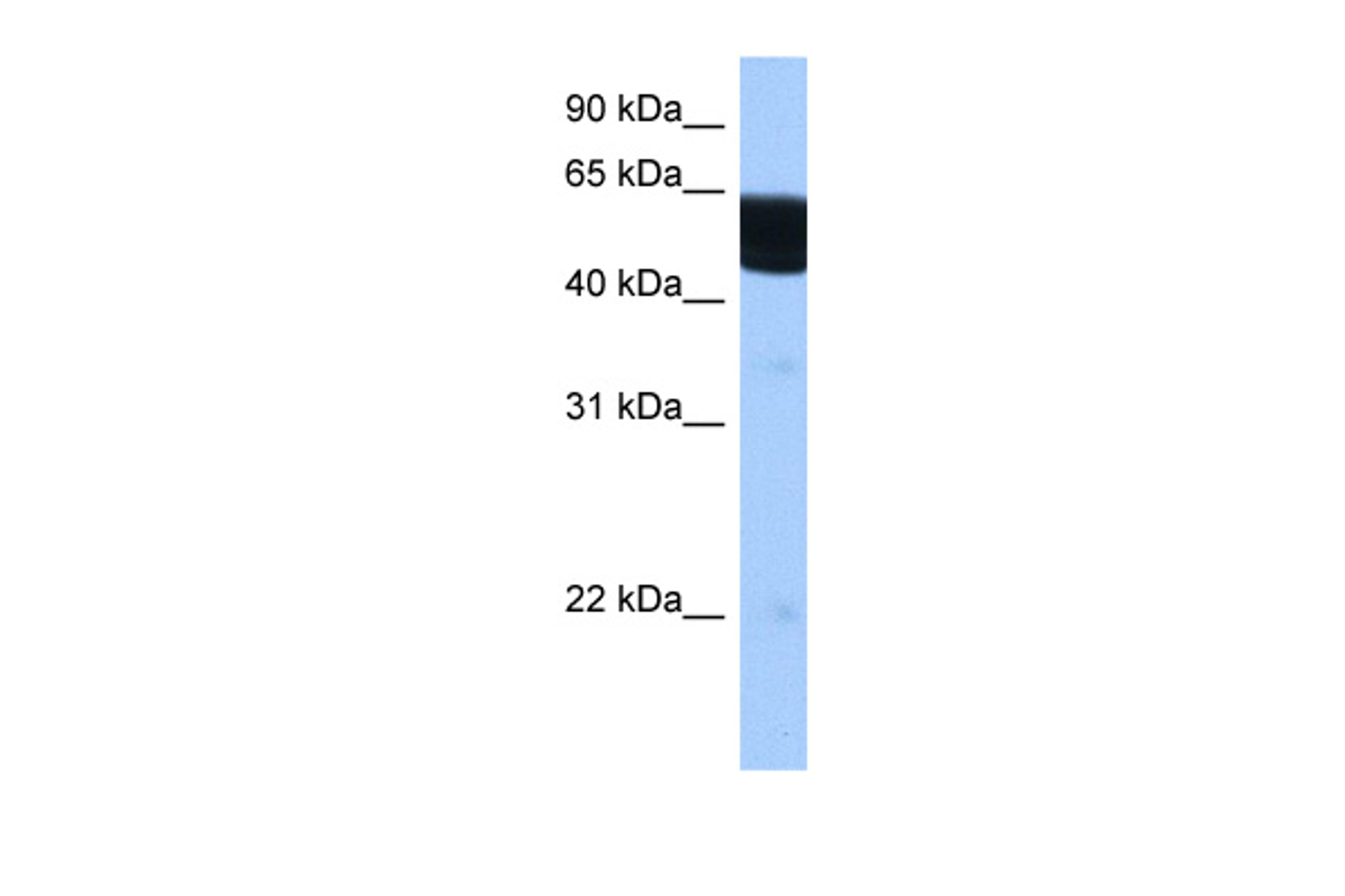 Antibody used in WB on Human Brain at 0.2-1 ug/ml.