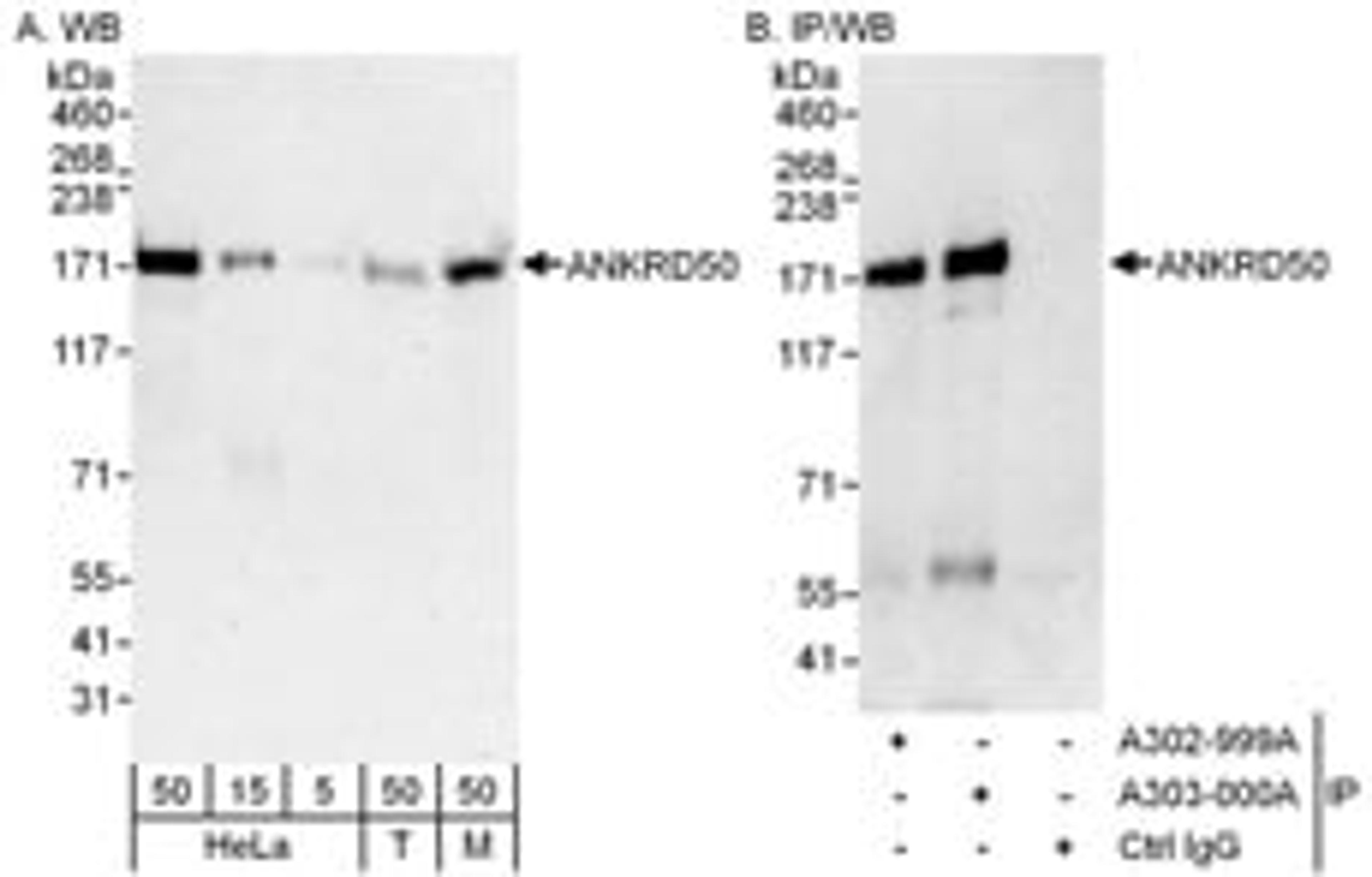 Detection of human and mouse ANKRD50 by western blot (h&m) and immunoprecipitation (h).